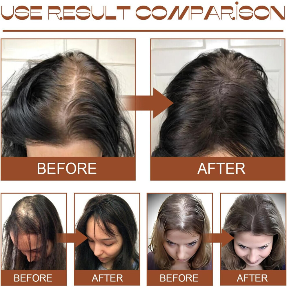 Batana Oil for Hair Growth – 100% Pure Organic Batana Oil, Raw &amp; Moisturizing Hair Butter for Healthy, Strong Hair