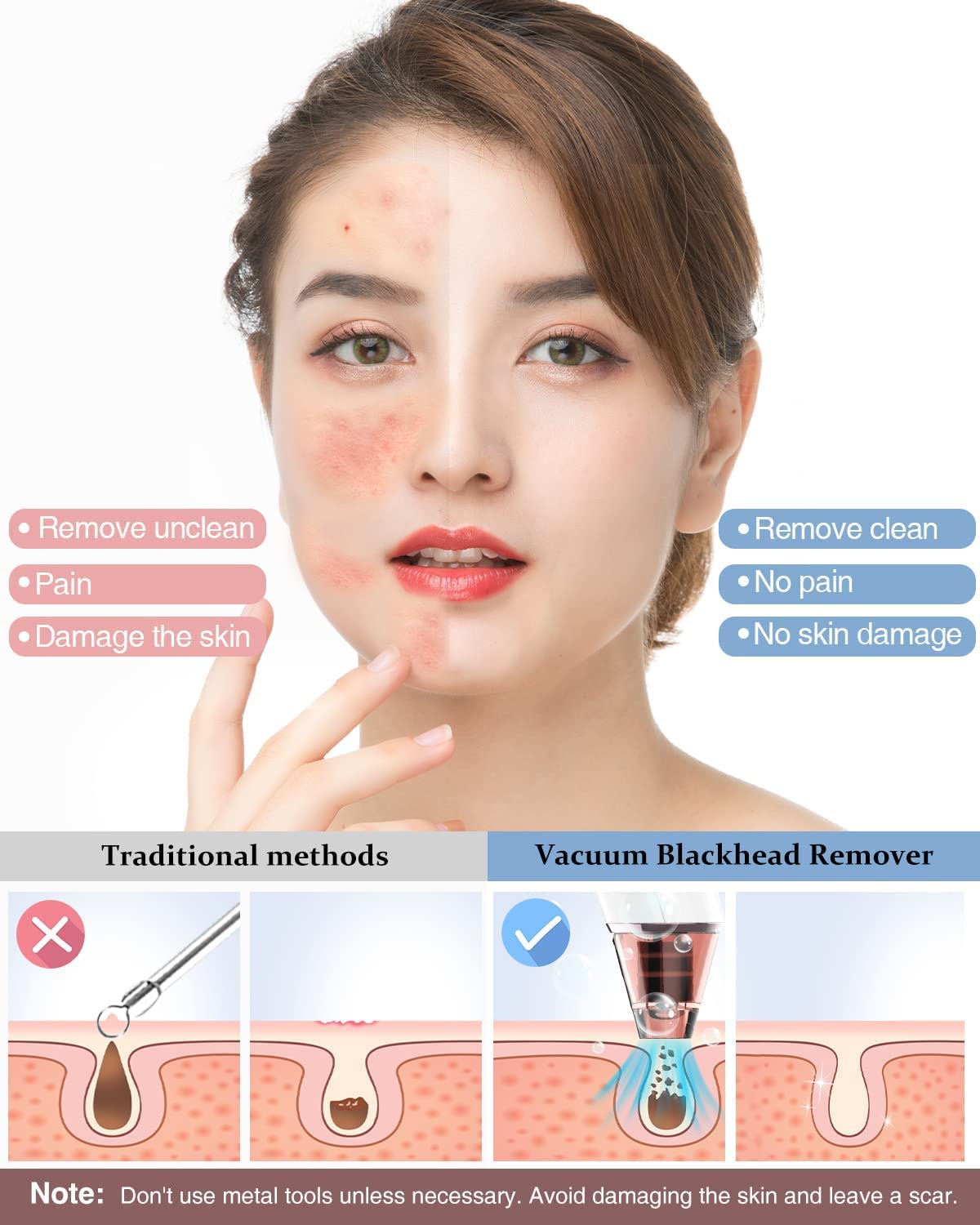 Blackhead Remover Vacuum Electric Pore Suction Remover Tools Acne Comedone Extractor Tool