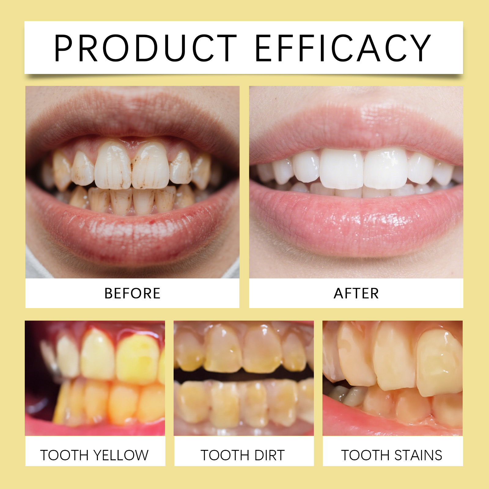 Astragalus Fresh Cleansing Dental Mousse Mild Clean Protect Teeth Remove Yellow Stains Daily Oral Care