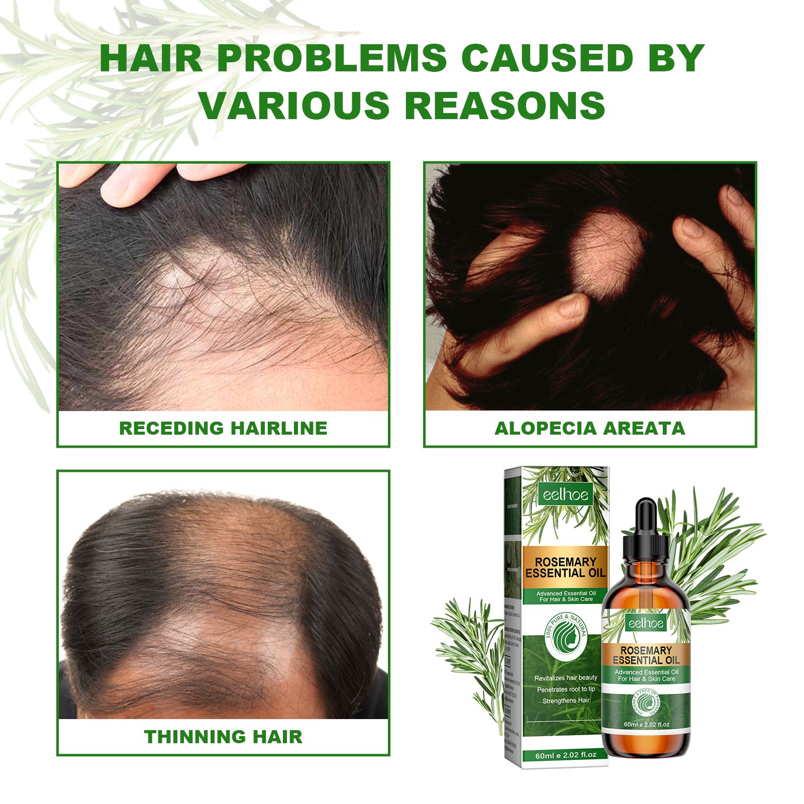 Rosemary Hair Oil Moisturizing Strengthening For Damaged Hair Smoothing And Daily Scalp Care