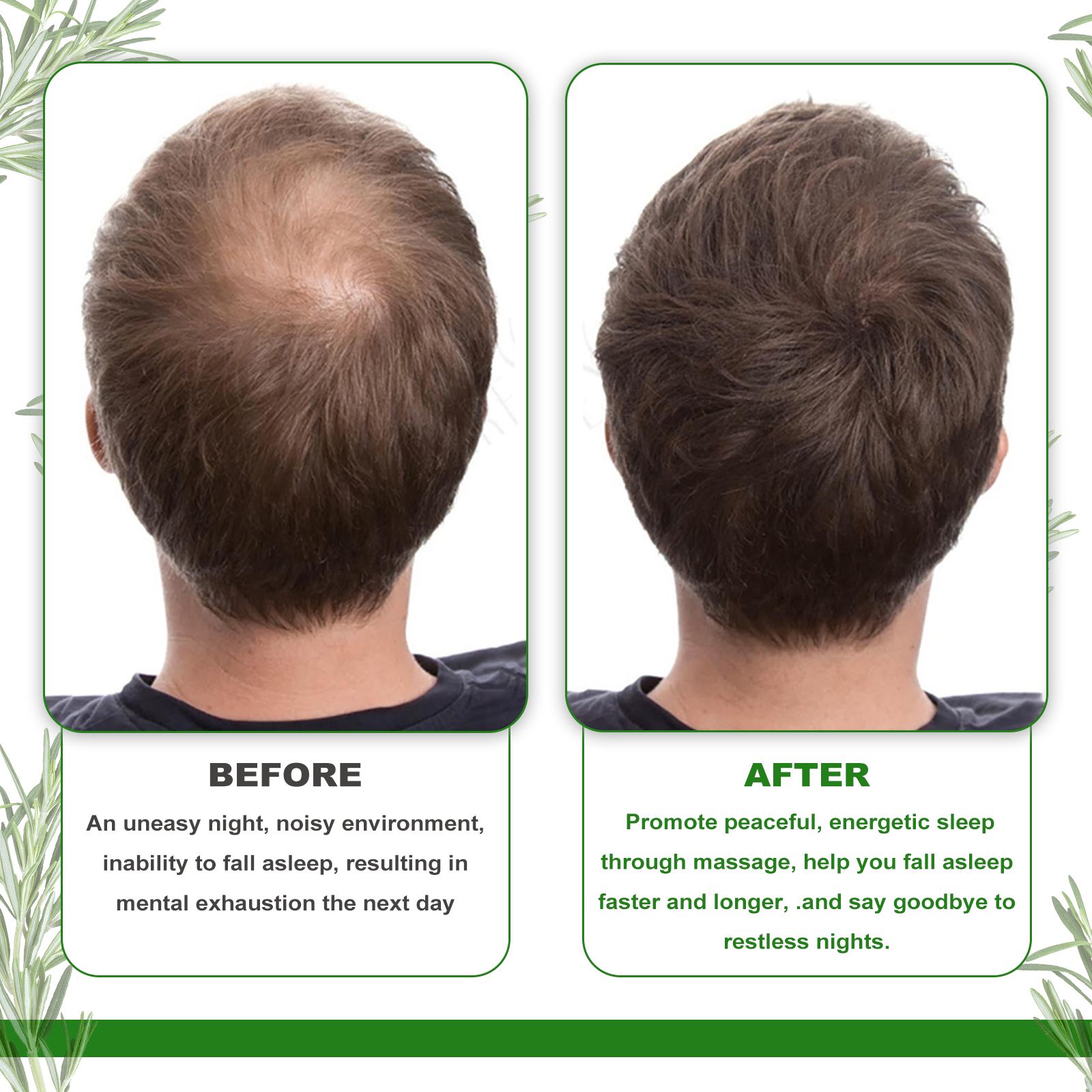 Rosemary Hair Oil Moisturizing Strengthening For Damaged Hair Smoothing And Daily Scalp Care