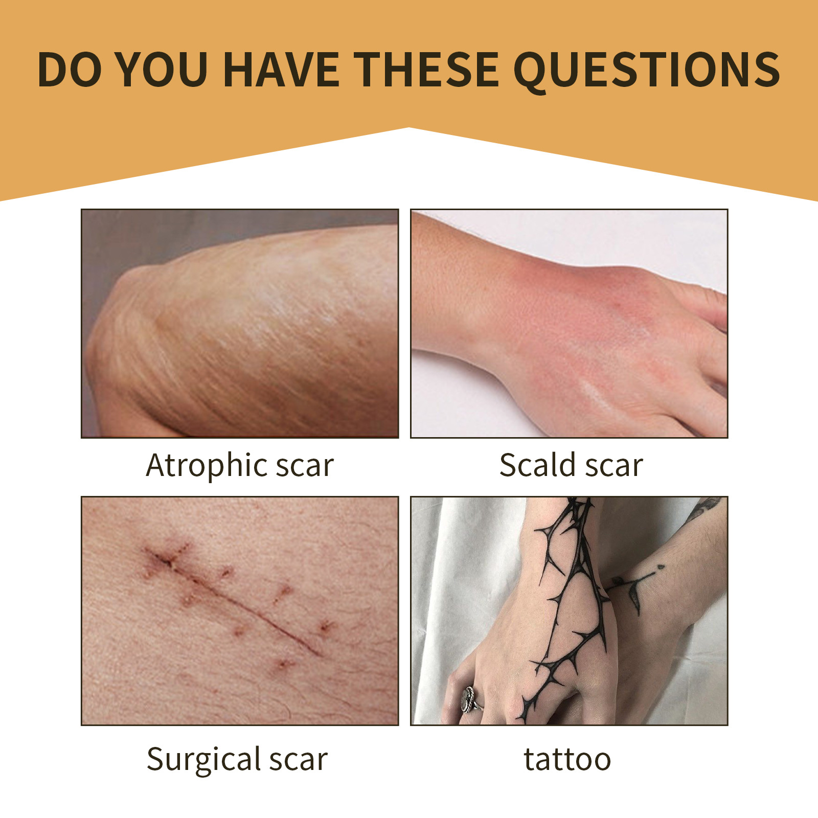 (6patch Boxed) Tattoo Concealer Patch Covering Patch Scar Patch Body Birthmark Conceal Skin Color Invisible Waterproof Long Lasting Tattoo Flaw Cover Stickers