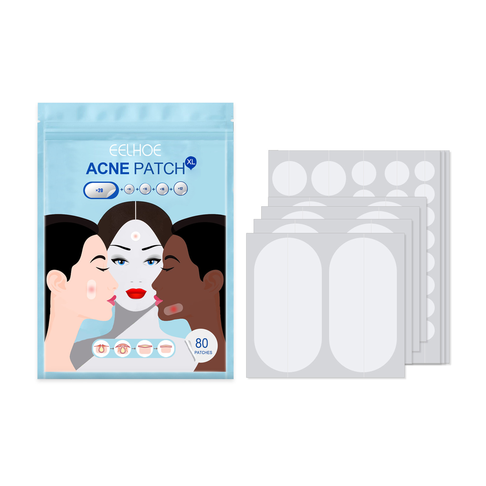80Pcs Large Size Acne Patches Removal Pimple Anti Acne Hydrocolloid Bandage Patches Spots Marks Concealer Repair Sticker Skin Blemish Remover Skin Care