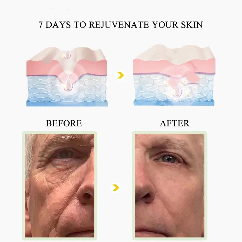 iBeaLee Retinol Whitening Cream Vitamin A Hydrating Nourishing Collagen Anti Aging Face Neck Anti Wrinkle Repair Cream Moisturize Firming Skin care