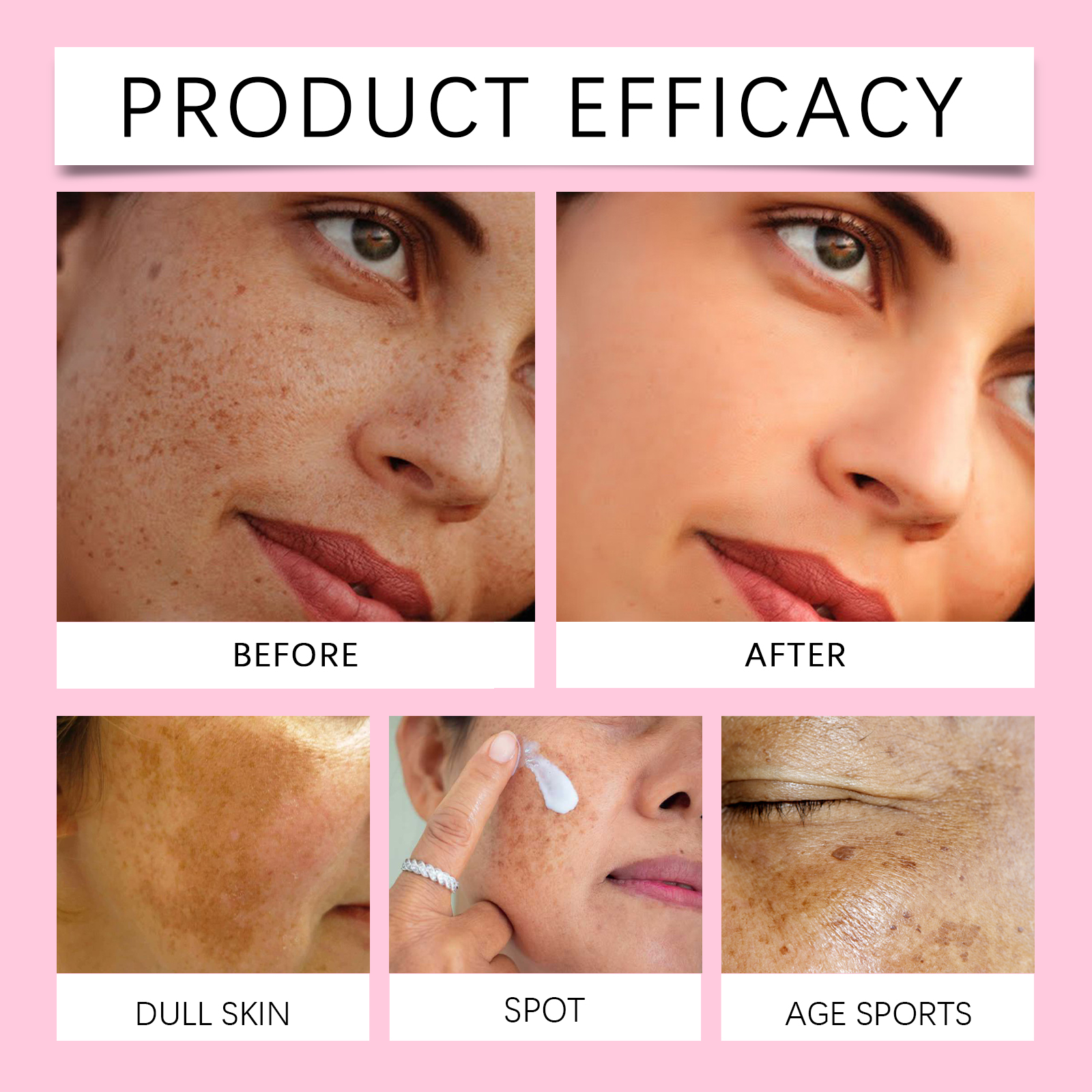 Arbutin Skin Cream Moisturize Hydrate Even Improve Facial Skin Bright Hydrating Care Cream