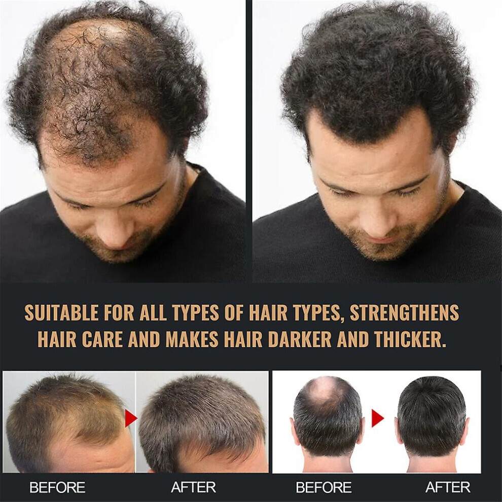 3pcs Root Activator Shampoo Hair Loss Shampoo Root Activator