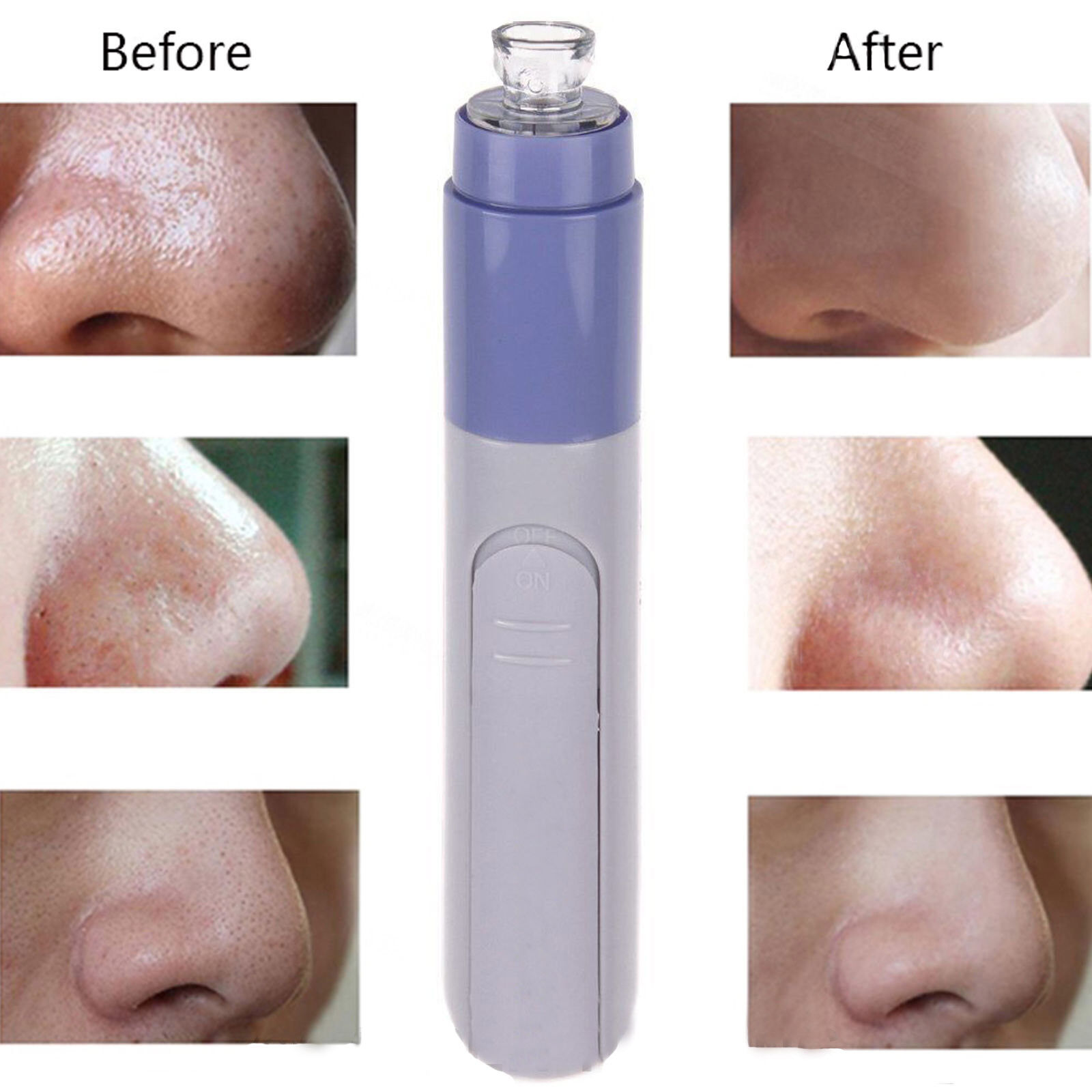 Electric Blackhead Remover Suction Facial Pore Cleaner Skin Face Machine Vacuum Facial Acne Dot Extractor