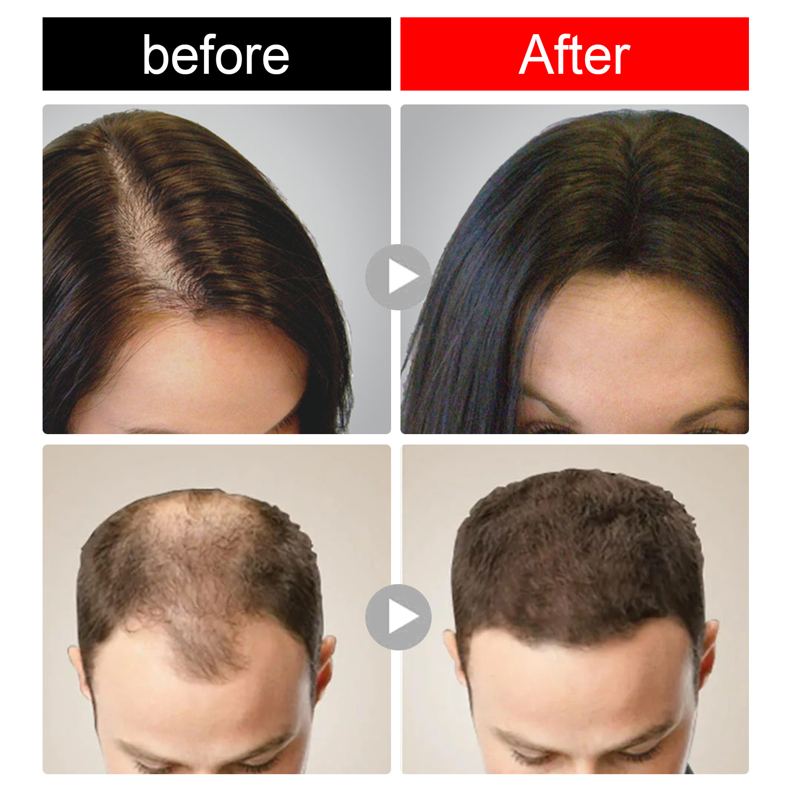 Rice Shampoo Bar Rice Soap For Hair Growth Fermented Rice Water Moisturizing Anti-Hair Loss For Women Men