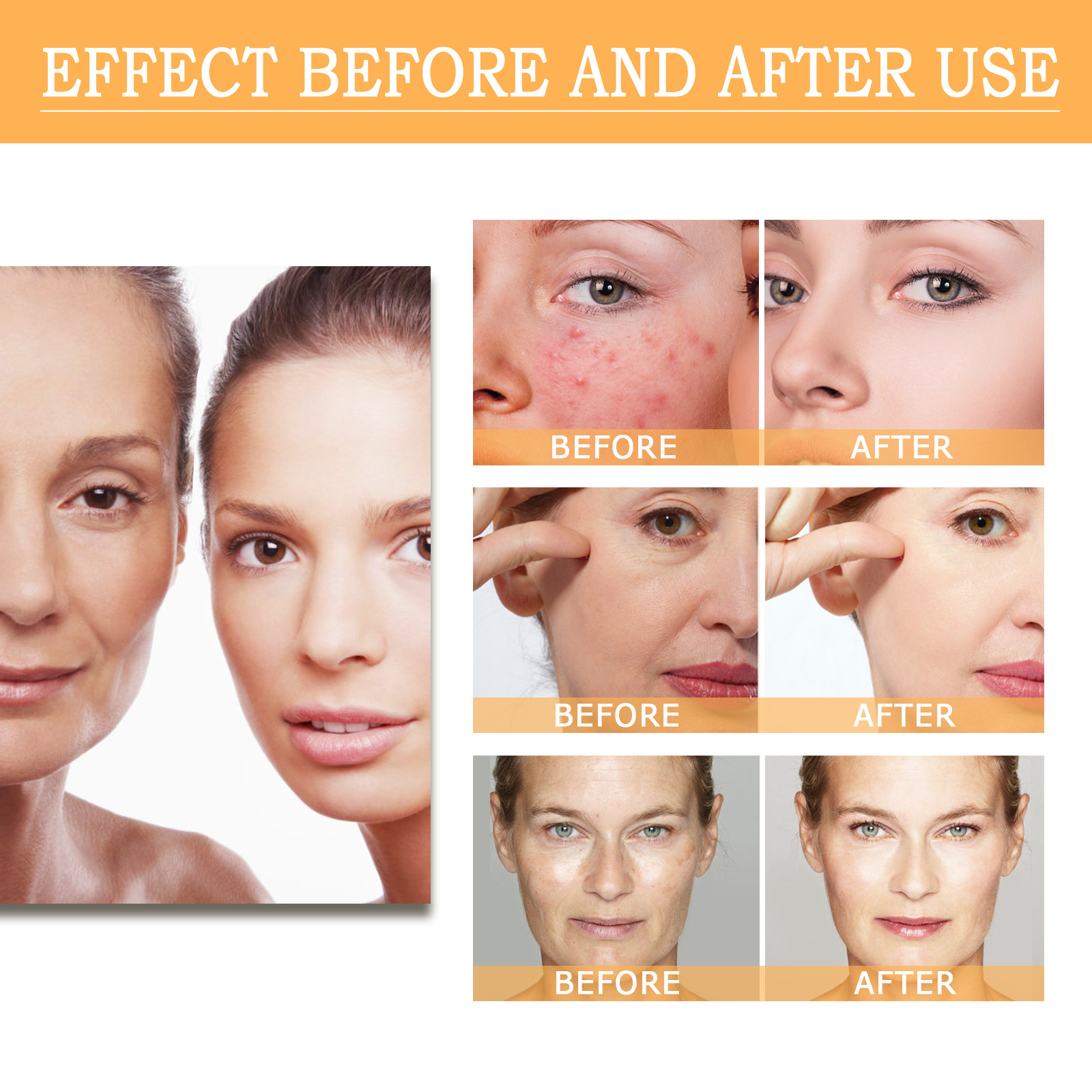 Face Toner for Women Glycolic Acid 7 Percent Toning Resurfacing Solution Improve Blemishes Remove Acne Marks Skin Care