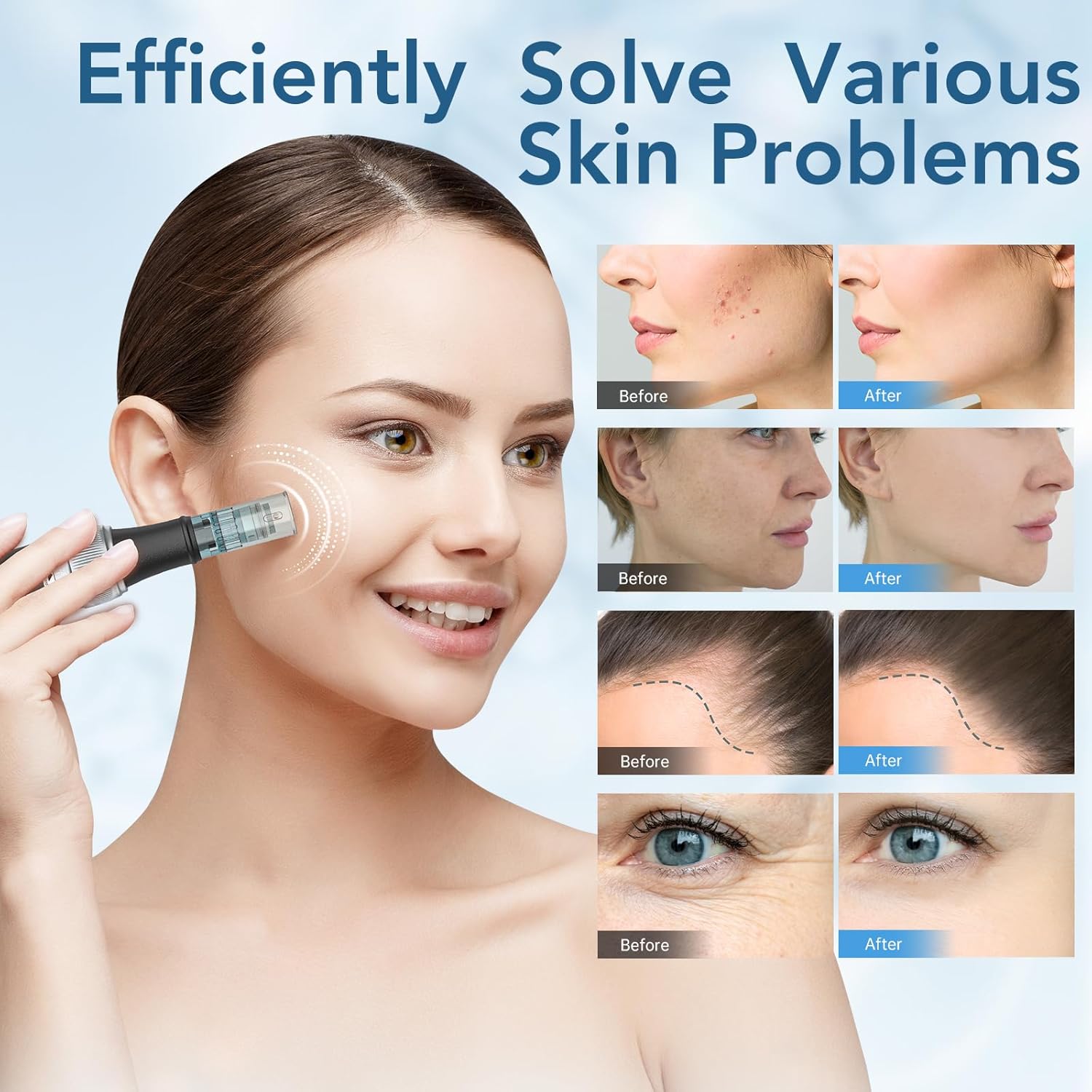 (Black) Dr. Pen M7S Professional Microneedling Pen Electric Skin Care Tool Adjustable Speeds Rechargeable Wrinkle Reduction Acne Scars Skin Brightening Pore Minimizing
