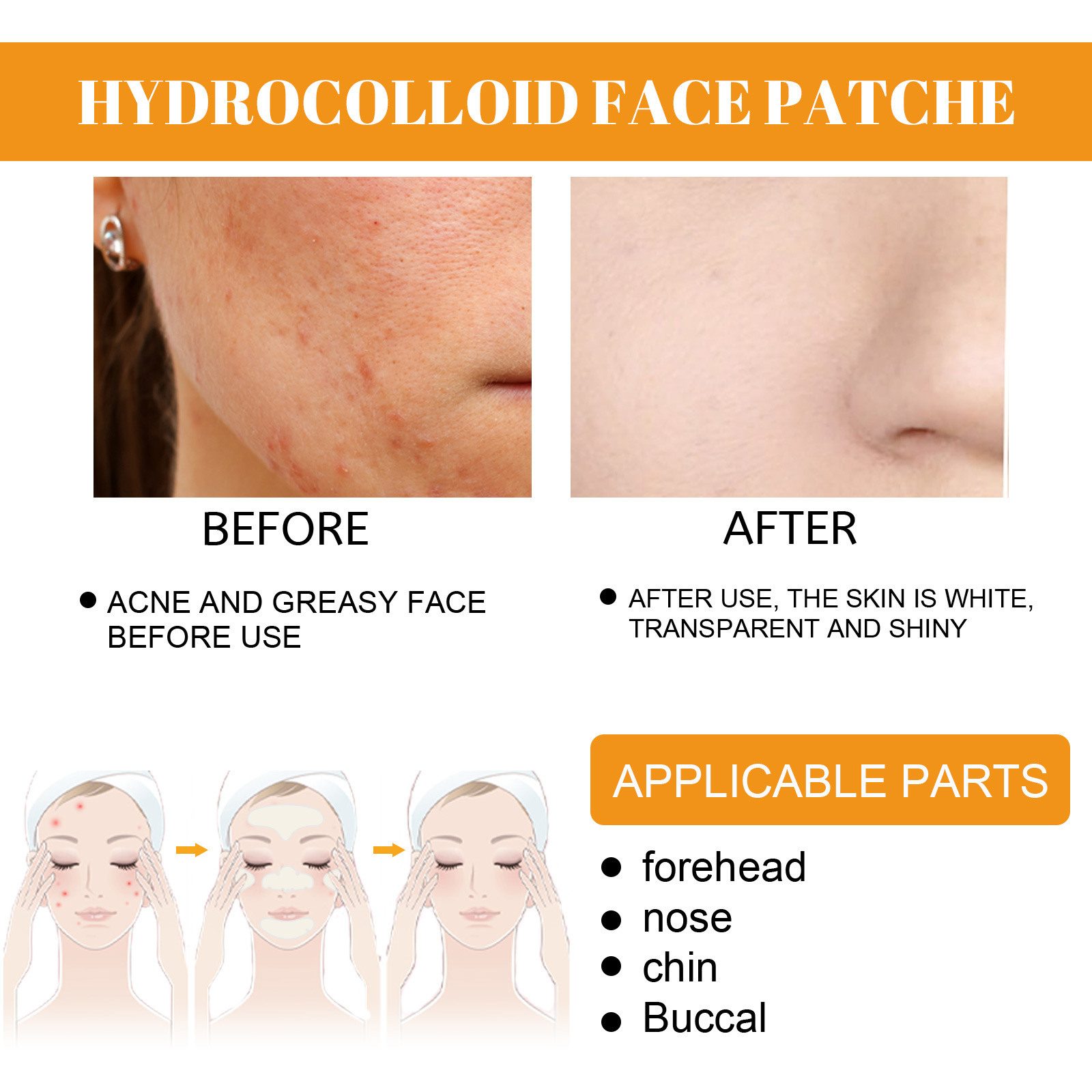 EELHOE Hydrocolloid Face Patche Oily Conbination Skin
