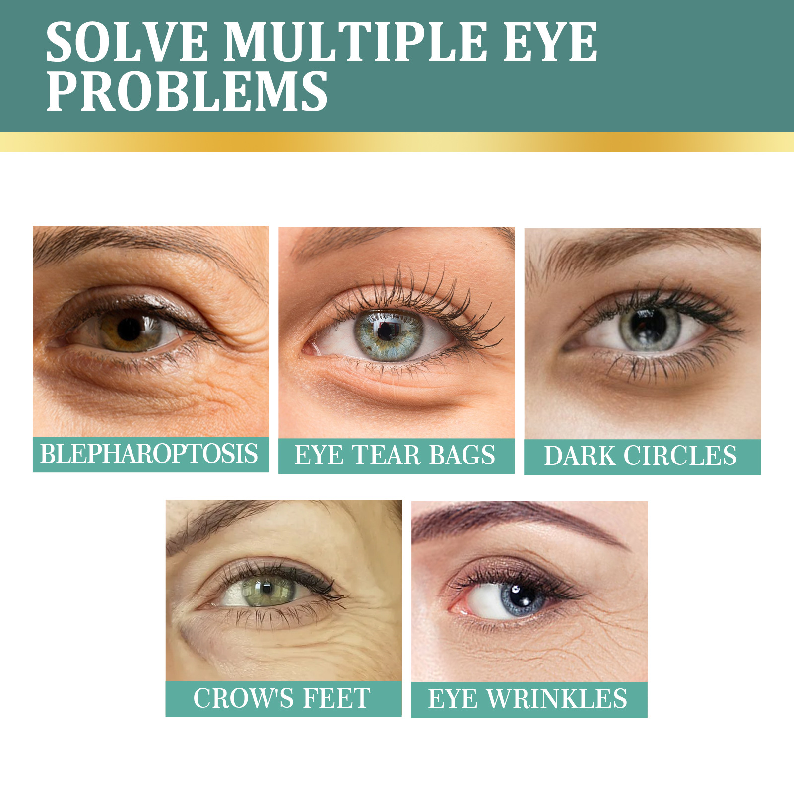 EELHOE Eye Cream Jasmine Ointment for Lightening Dark Circles Remove Eye Bags Puffiness Lifting Firming Eyes Care Moisturizing Anti Wrinkle Eye Cream