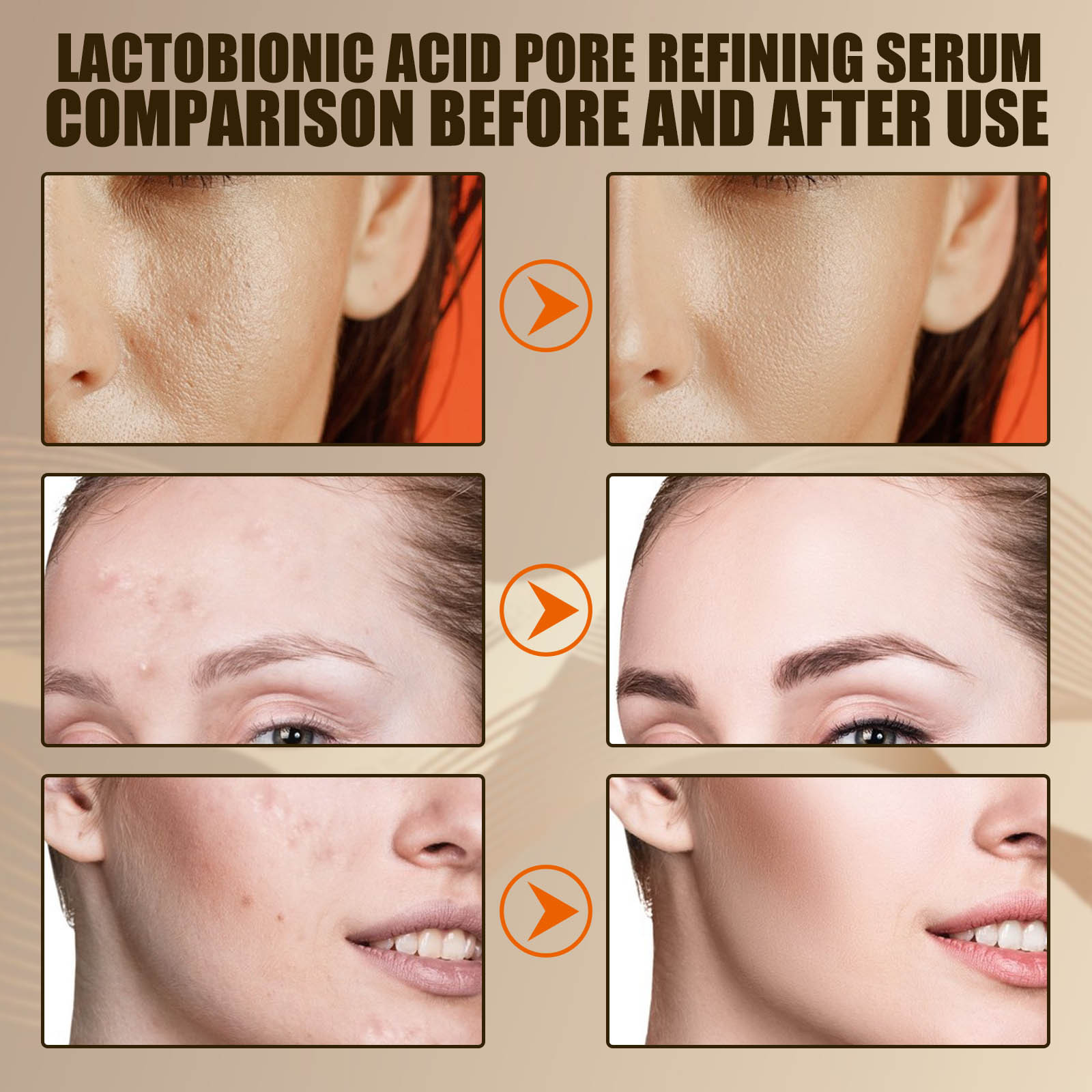 Lactobionic Acid Pore Shrink Face Serum Hyaluronic Acid Moisturizer Nourish Essence Firm Refine Skin Texture Elasticity Cleanse Blackheads Whiteheads 30ml