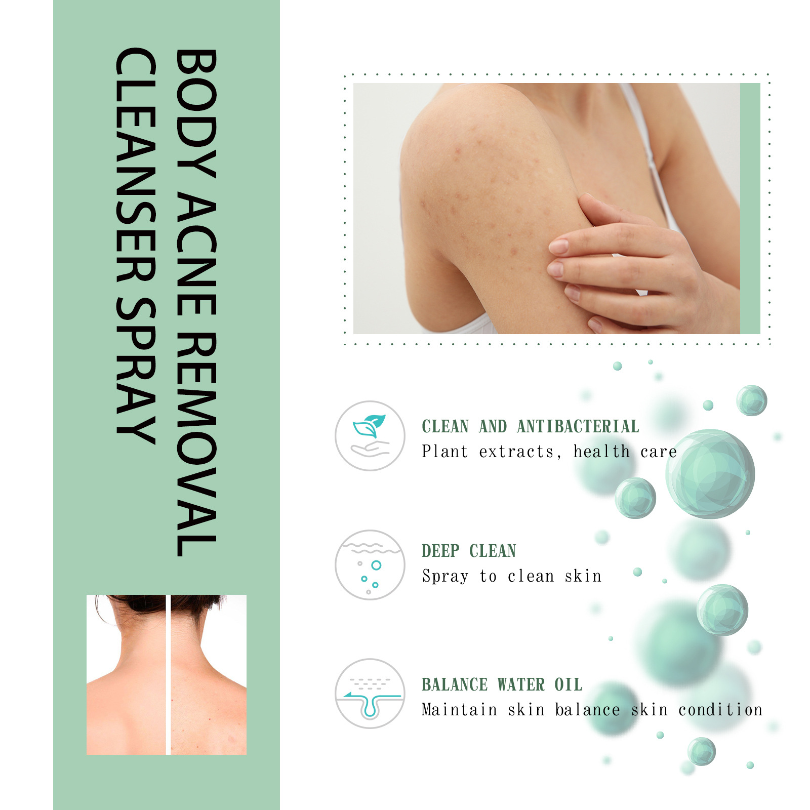 (1 PC) Body Acne Removal Cleanser Spray for Back and Arm Anti-acne Water Oil Balance Remove Redness Shrinking Pores Clean Body Pimple Remover Spray