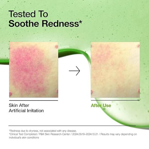 ANUA Azelaic Acid Serum Hydrating Blemish Care for Sensitive Skin