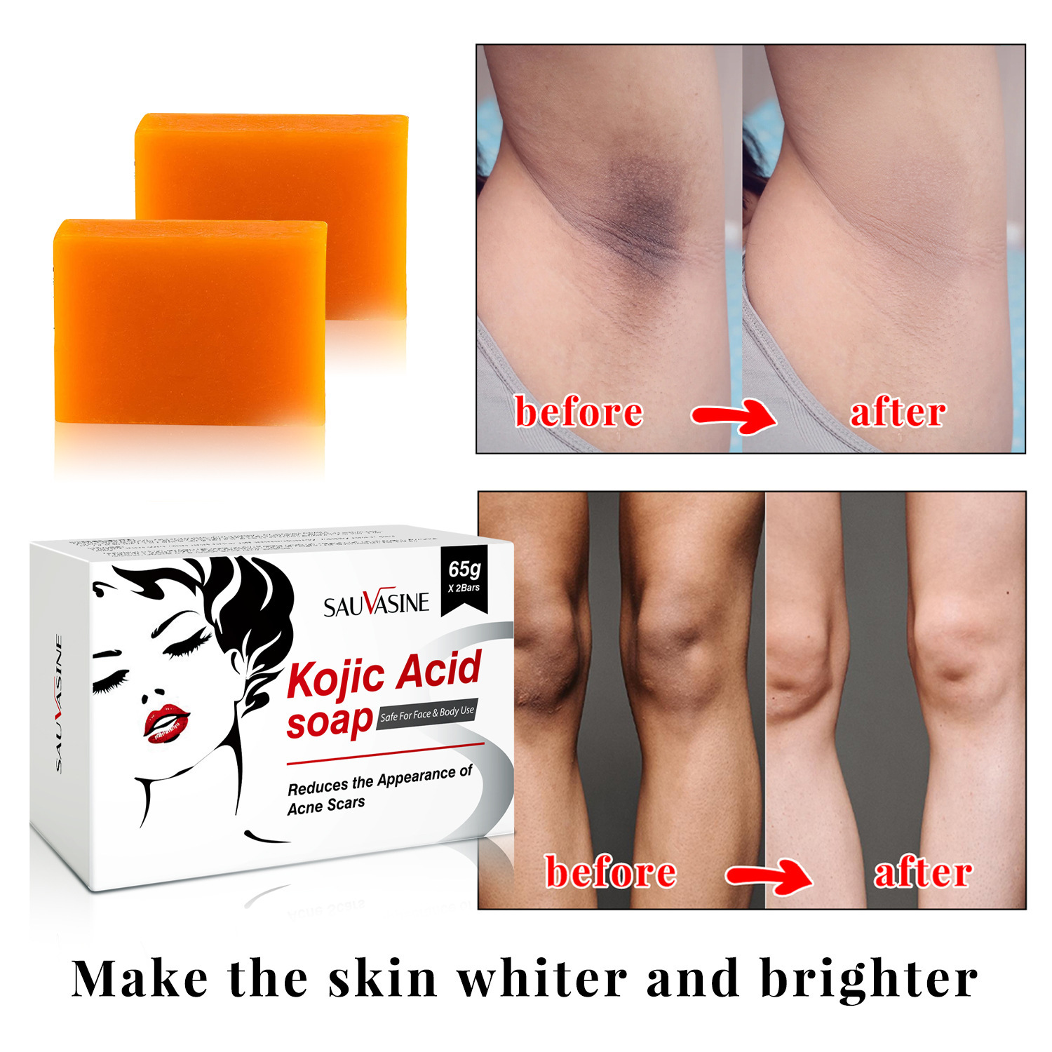 Kojic Acid Soap Skin Brightening Deep Cleansing Exfoliating Moisturizing For Face Body Daily Bath And Shower Bar