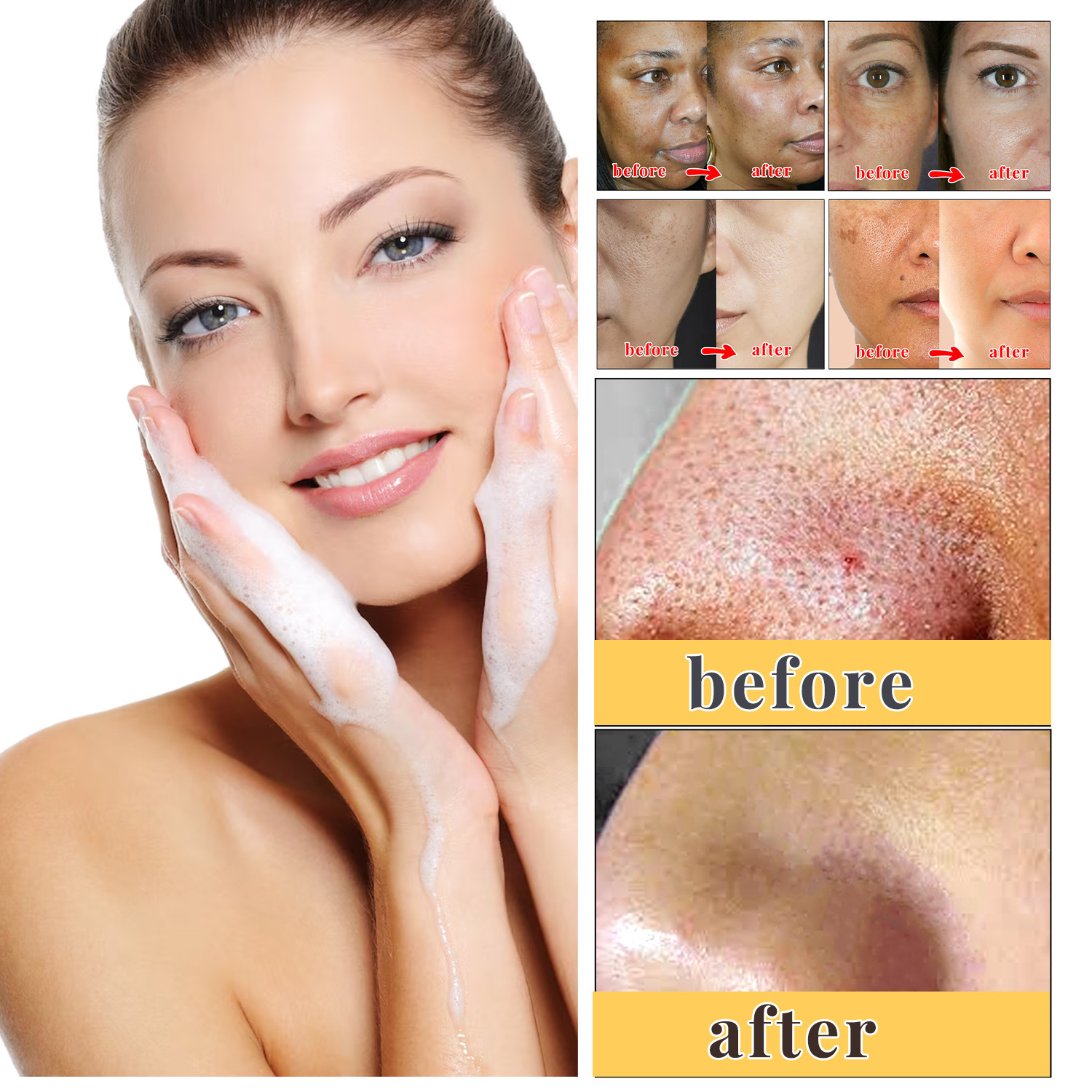 Kojic Acid Soap Skin Brightening Deep Cleansing Exfoliating Moisturizing For Face Body Daily Bath And Shower Bar
