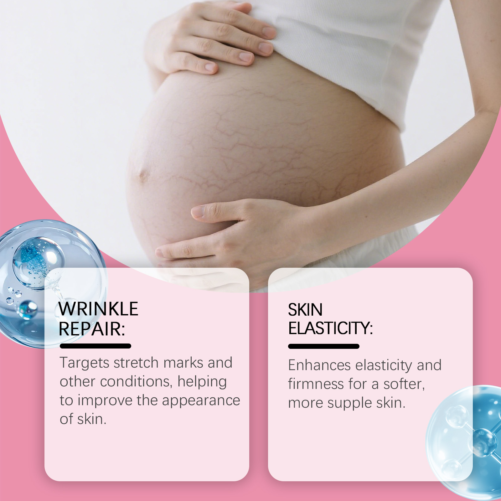 Rose Skin Care Cream For Pregnant Nourish Skin Elastic Smooth Moisturize Daily Smear Massage Body Skin