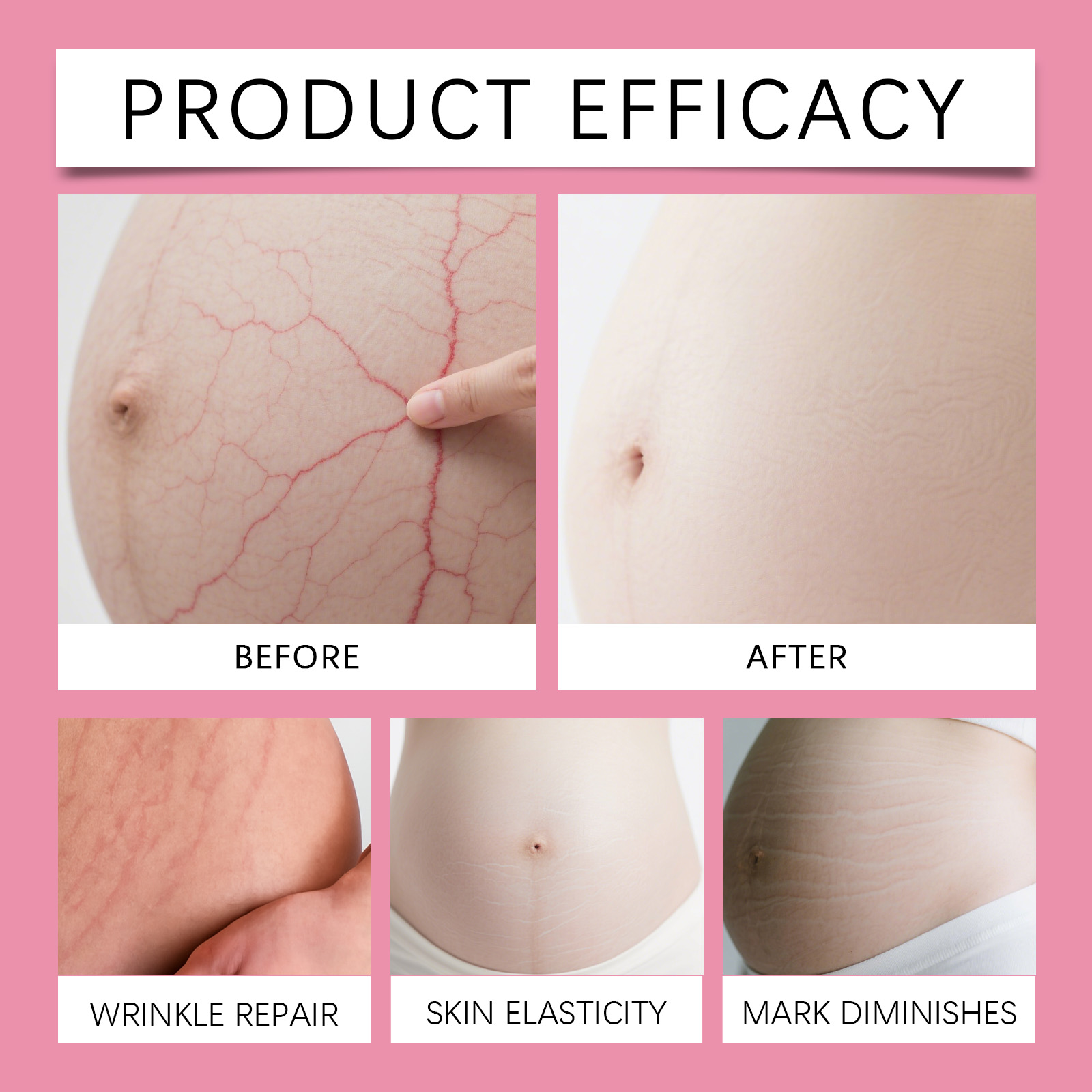 Rose Skin Care Cream For Pregnant Nourish Skin Elastic Smooth Moisturize Daily Smear Massage Body Skin