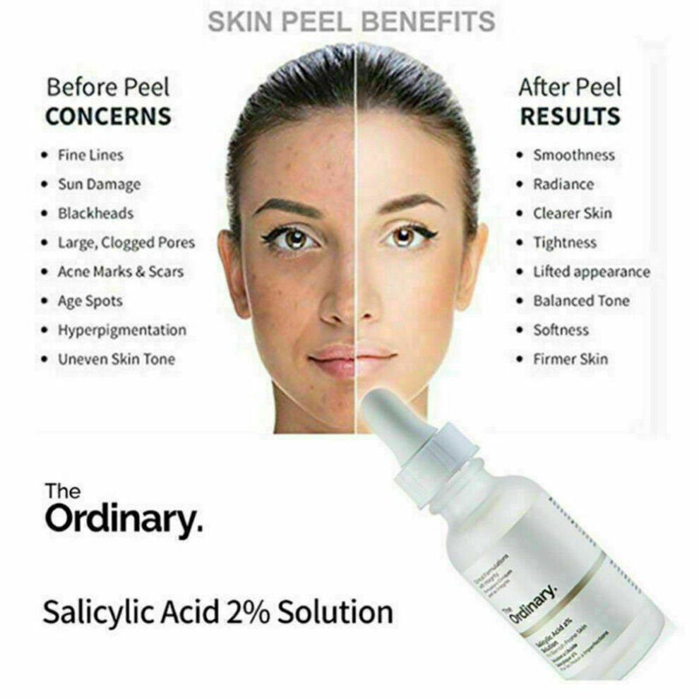 The Ordinary Salicylic Acid 2 Solution 30ml 2 Skin Peel Exfolia