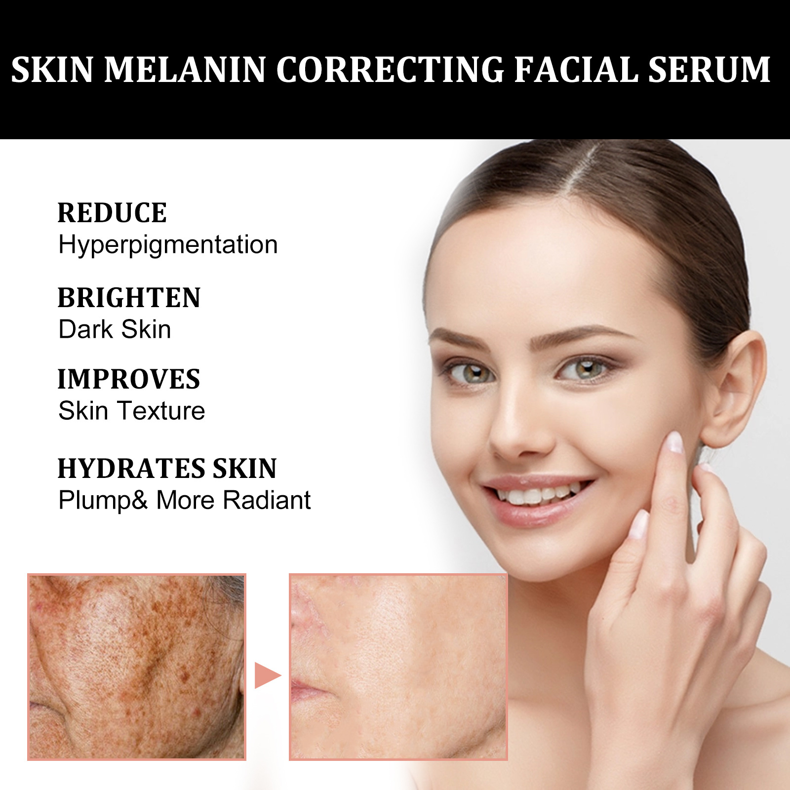 EELHOE Skin Melanin Correcting Serum Fade Dark Spots Anti Freckle Melasma Remover Dull Skin Nourish Lighten Pigment Blemish Glow Vitamin C Face Essence.