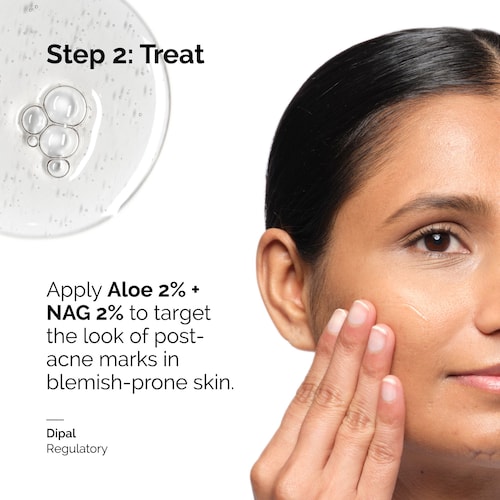 The Ordinary Aloe 2 Percent NAG 2 Percent Solution 30ml