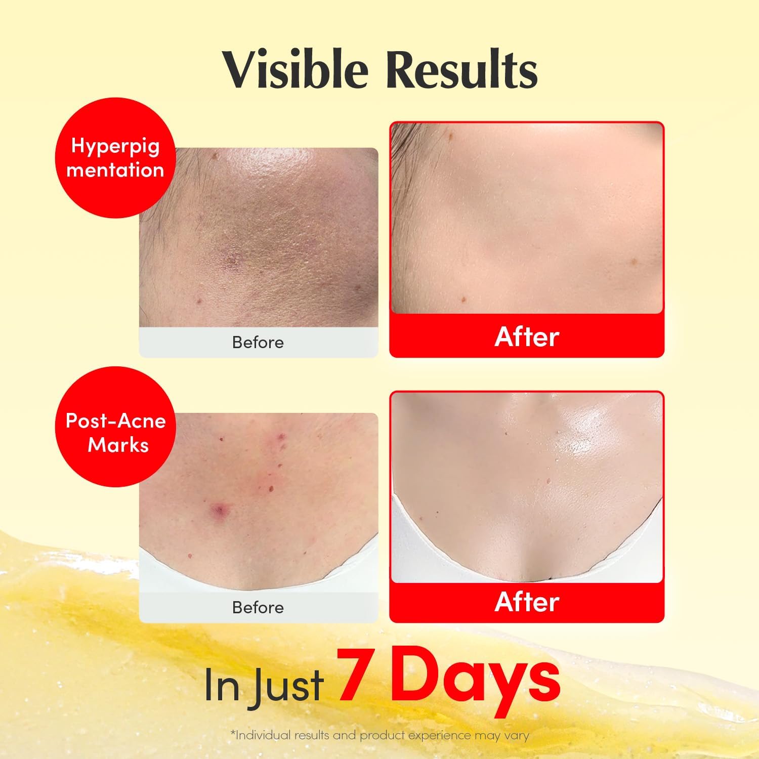EQQUALBERRY Vitamin Illuminating Cream 50ml Brightening Face Body Moisturiser Niacinamide Tranexamic Acid Vitamin CLightweight Hydration Skin Tone Support New