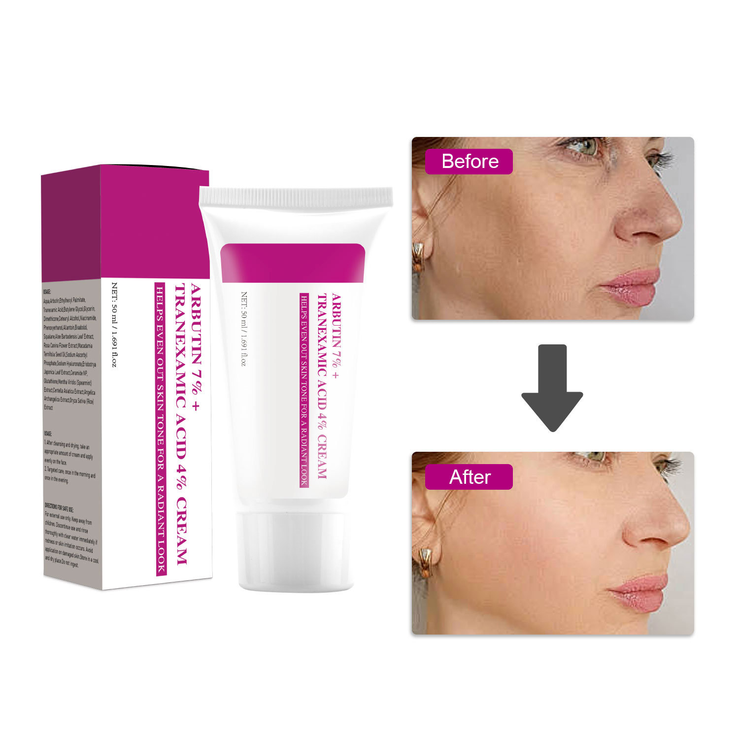 Arbutin Tranexamic Acid Face Cream 7% Arbutin and 4% Tranexamic Acid Brightening Moisturising for Skin Care Home Use Natural