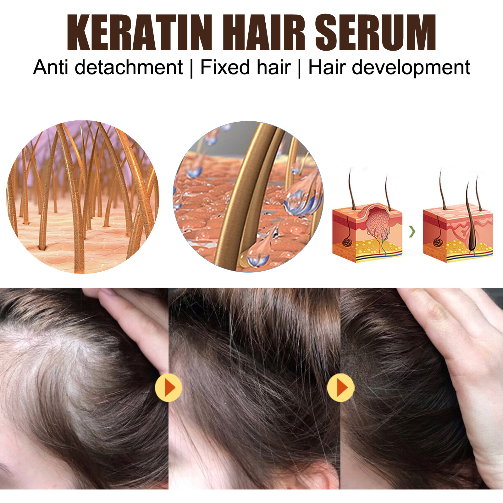 Hair Serum Dense Hair Essence Moisturizing Hair Repair Hair Root Thickening Hairline Strengthening Firming Hair Care