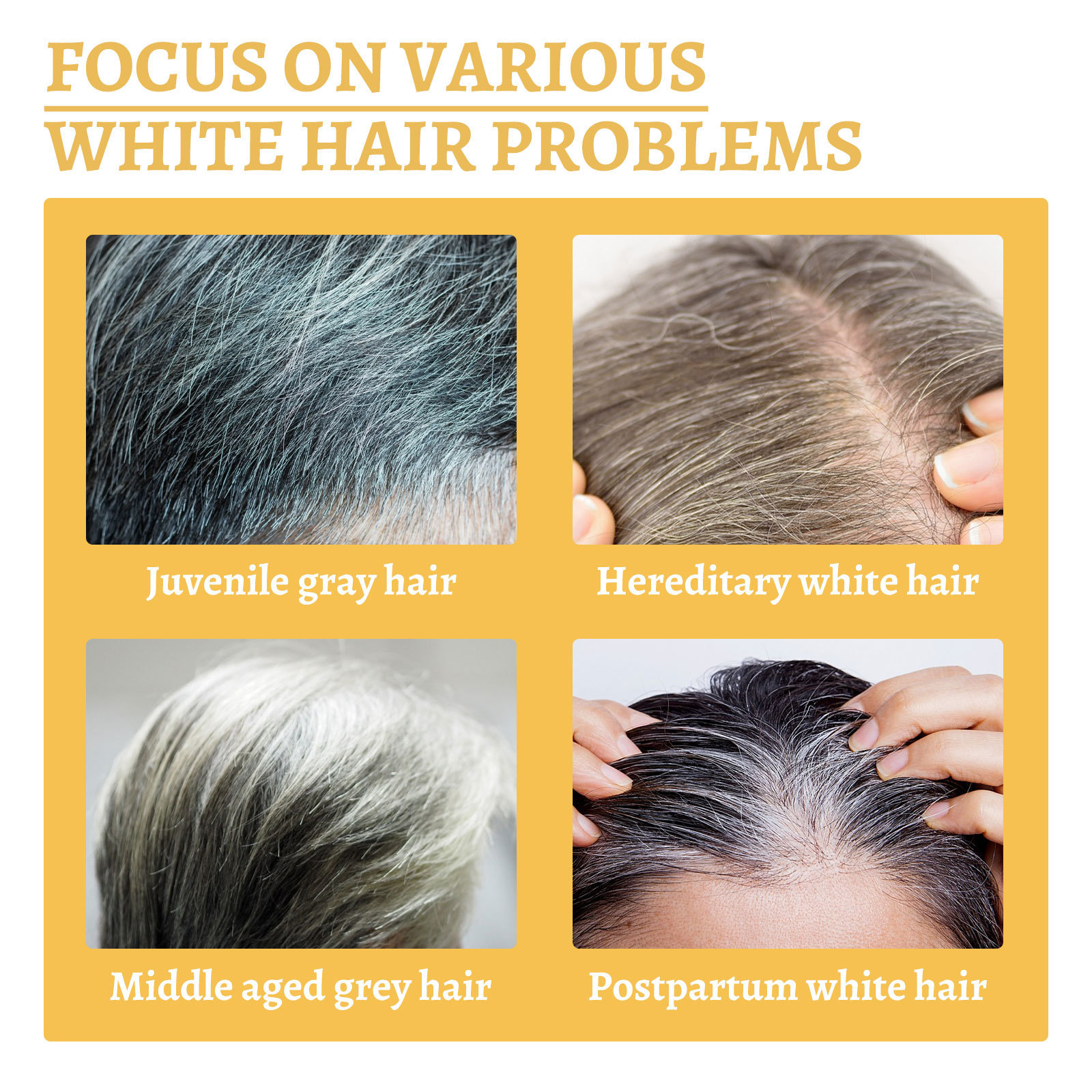 White To Black Hair Oil For Repairing Nourishing Moisturizing Scalp Herbal Lotion Liquid Repair Hair Care Treating Hair Loss Anti-Breakage Hair