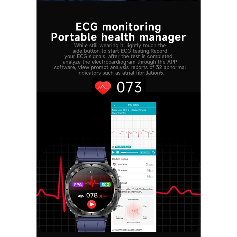 ECG Blood Glucose Smart Watch Men Uric Acid Blood Fat Heart Rate Micro Physical Examination Health Smartwatch