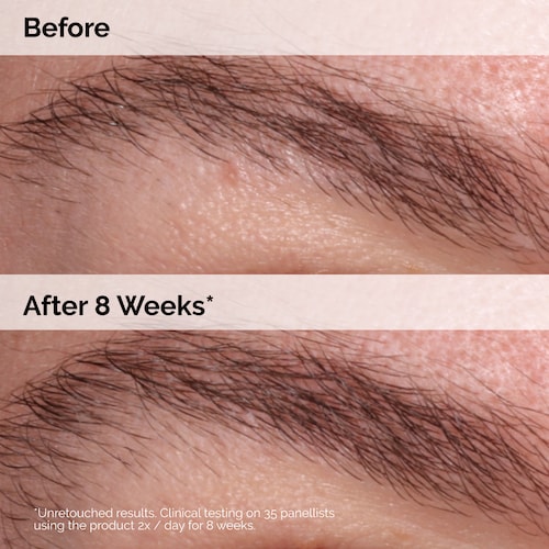The Ordinary Multi Peptide Lash and Brow Serum 5ml