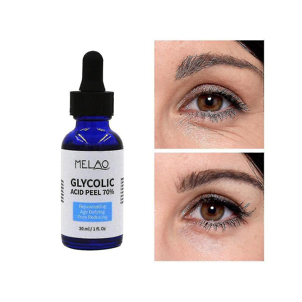 Glycolic Acid Peel Purity 70 Concentration 5 Skin Repair Invisible Pores Brighten Skin Tone Treat Acne Mild And Non-irritating-mxbc