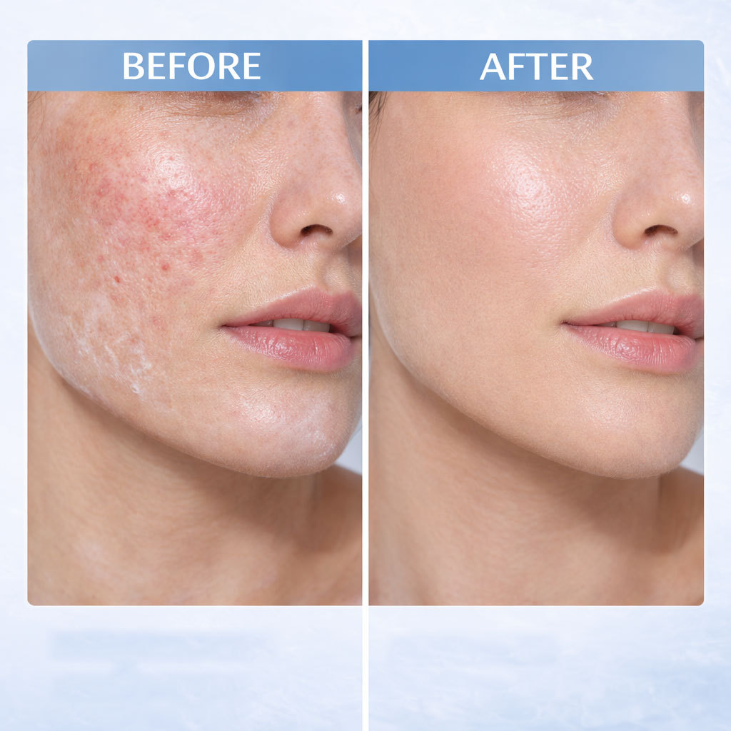 Hyaluronic Acid Cica Water Essence UV Shield For Hydrating Soothing And Daily Sun Protection Serum 50ml