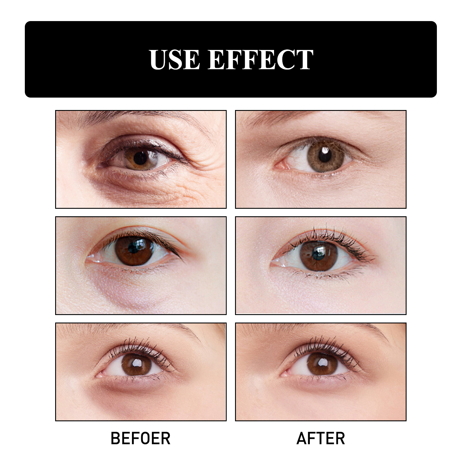 Eye Firming Cream Fades Fine Lines Moisturizes Nourishes Tightens Eye Skin Daily Massage Care