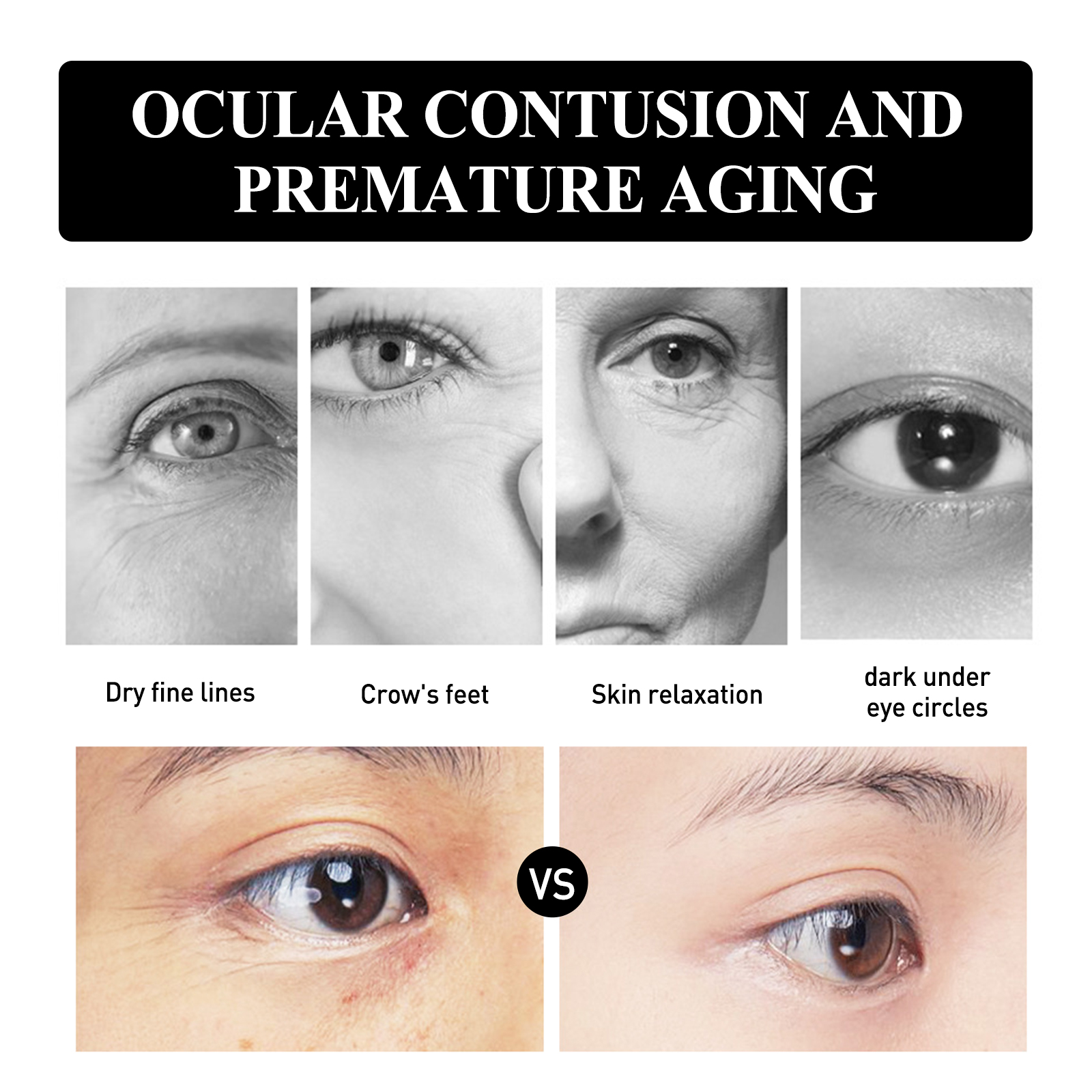 Eye Firming Cream Fades Fine Lines Moisturizes Nourishes Tightens Eye Skin Daily Massage Care