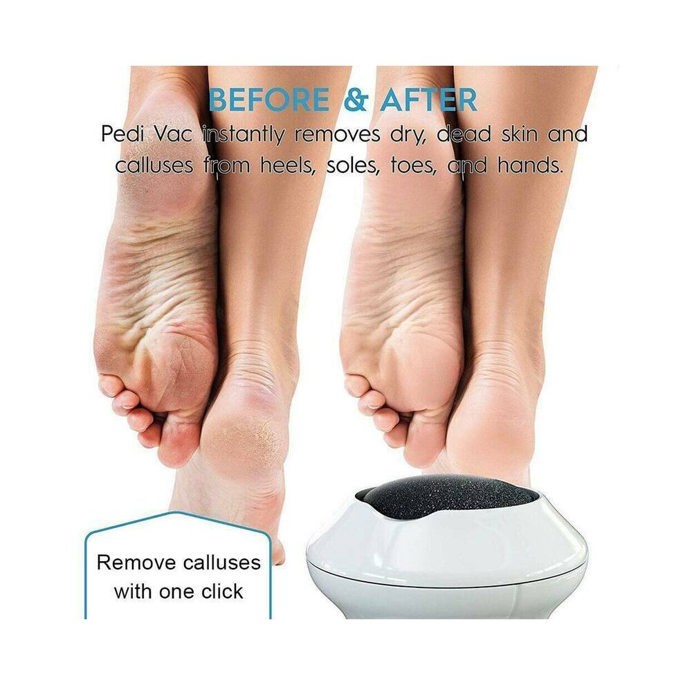 Portable Electric Foot Grinder Electric Vacuum Foot Callus Remover Electric Vacuum Adsorption Foot Grinder Foot Heel Repair Electric Foot File Pedicure Adsorption Foot Care Tool for Dead Hard Cracked Dry Skin Callus Crusty Remover