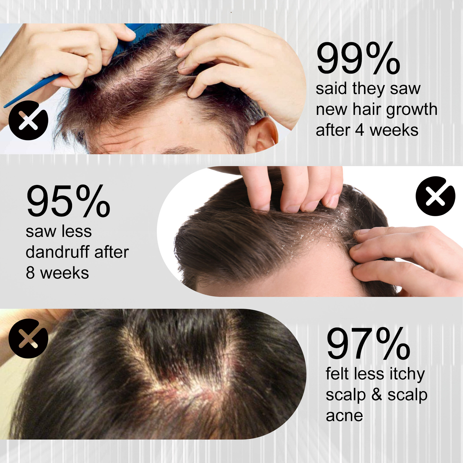 Anti Shedding Hair Spray Hair Growth Essence Hair Care Serums Improves Hairline Density Strengthens Hair Nourishes Hair Root Gel 100ml