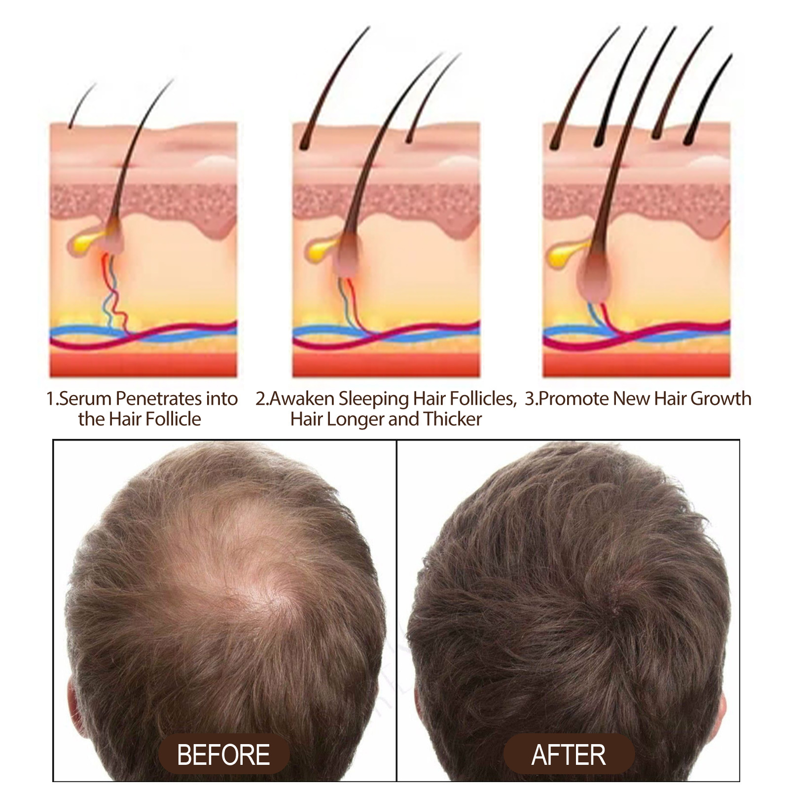 Hair Serum Dense Hair Essence Moisturizing Hair Repair Hair Root Thickening Hairline Strengthening Firming Hair Care