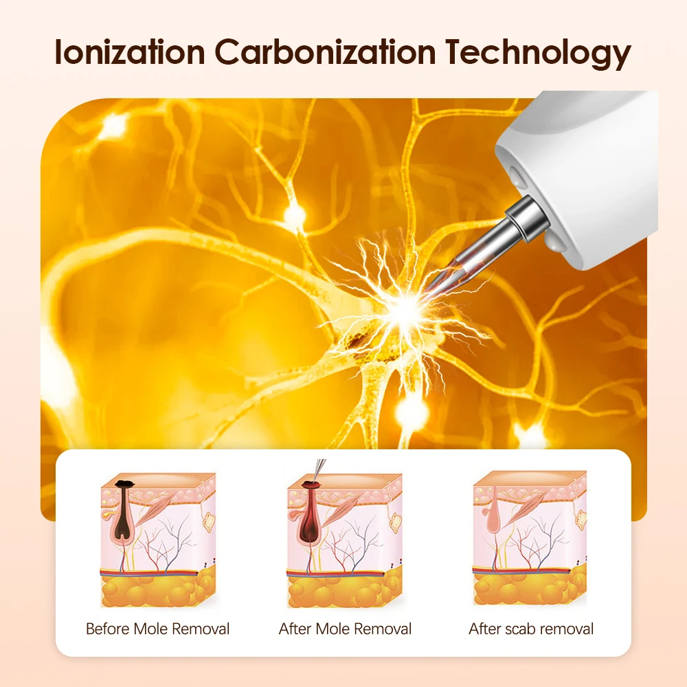 Electric Plasma Pen 9 Modes Auto Blackhead Skin Tag Mole Removal Neck Wart Freckle Nevus Dark Spot Black Dots Face Beauty Skin Care Machine LCD Display