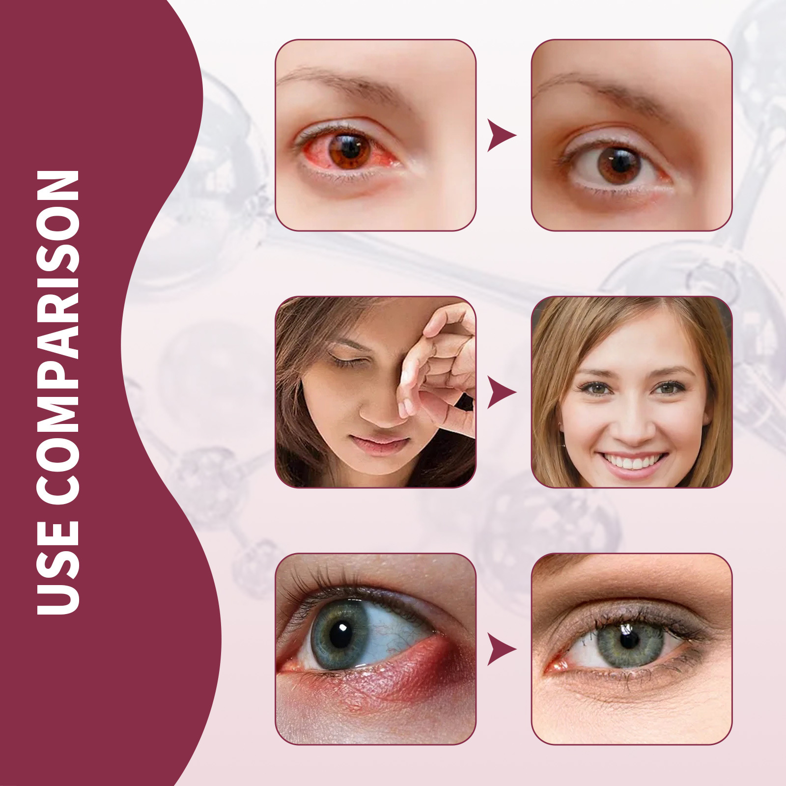 (1pc) Jaysuing Eye Swelling Relief Essence Relieve Fatigue Eyesight Remove Fat Granule Improve Redness Stye Eye Treatment Moisturizes Eye Serum 30ml