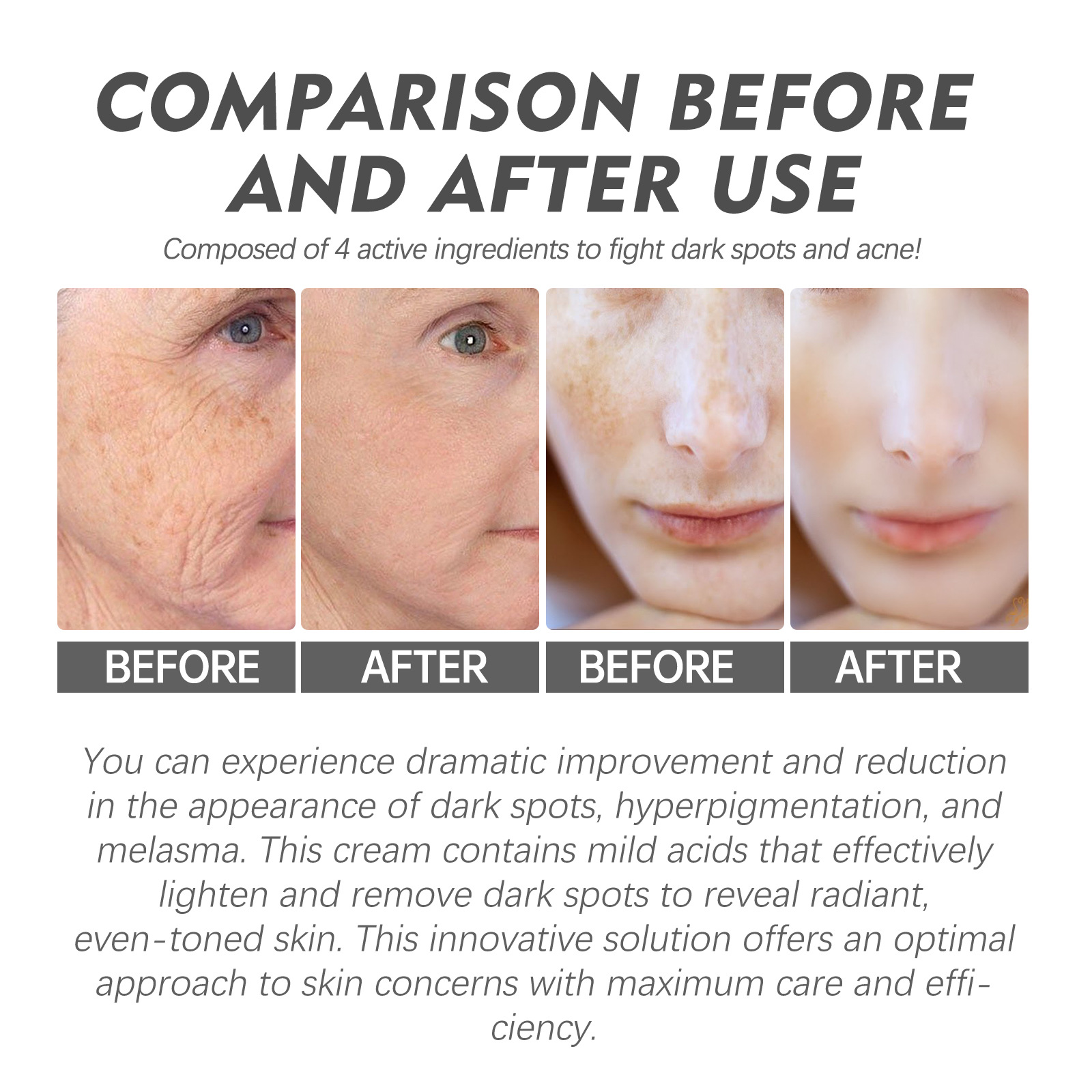 (1PC) Dark Spots Remover Cream Face Cream Fade Uneven Pigment Brightening Shrink Pores Moisturize Lighten Soften Improve Dull Skin Reduces Fine Lines Facial Care