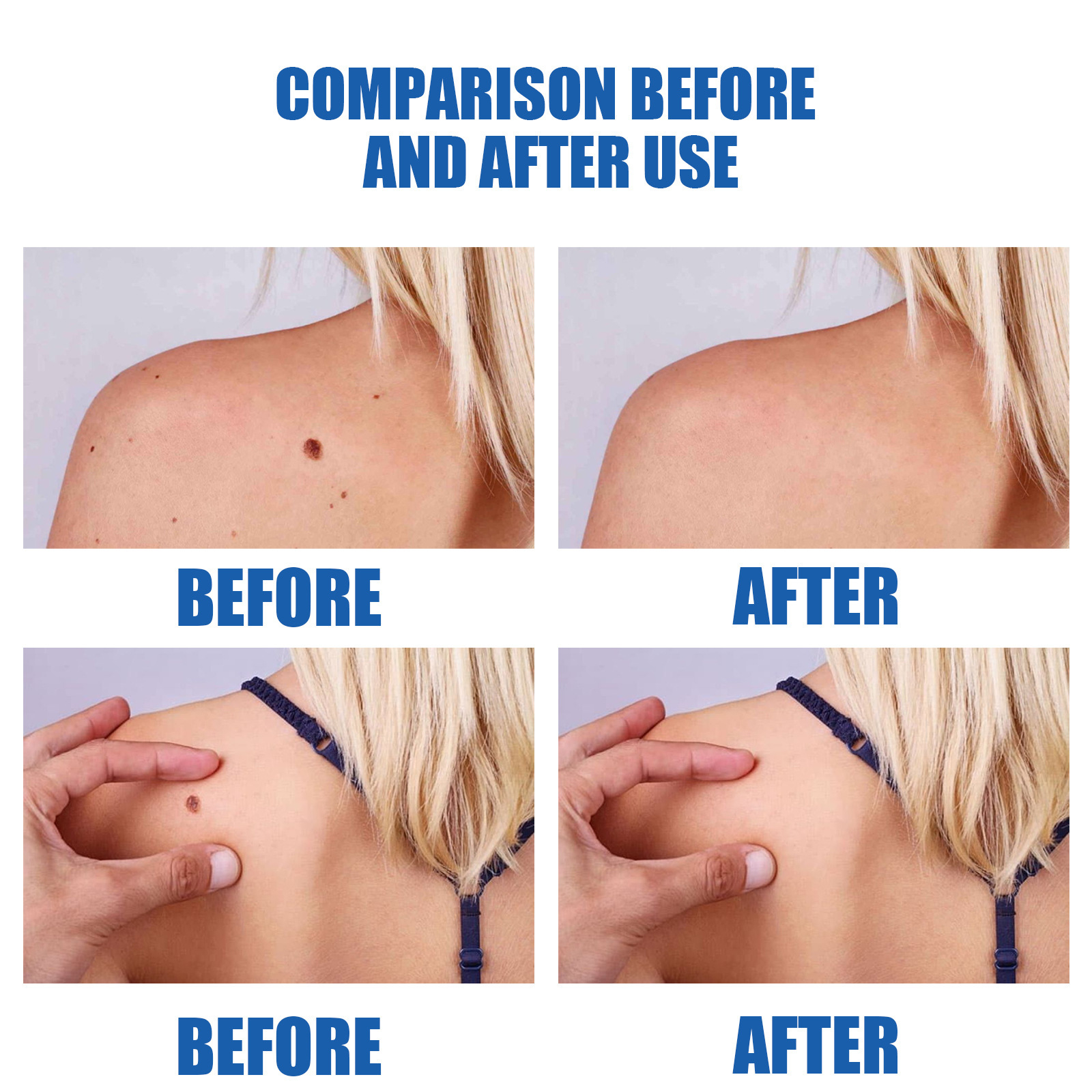Skin Care Pen For Face And Body Gentle Blemish Cleansing And Daily Skin Maintenance Treatment