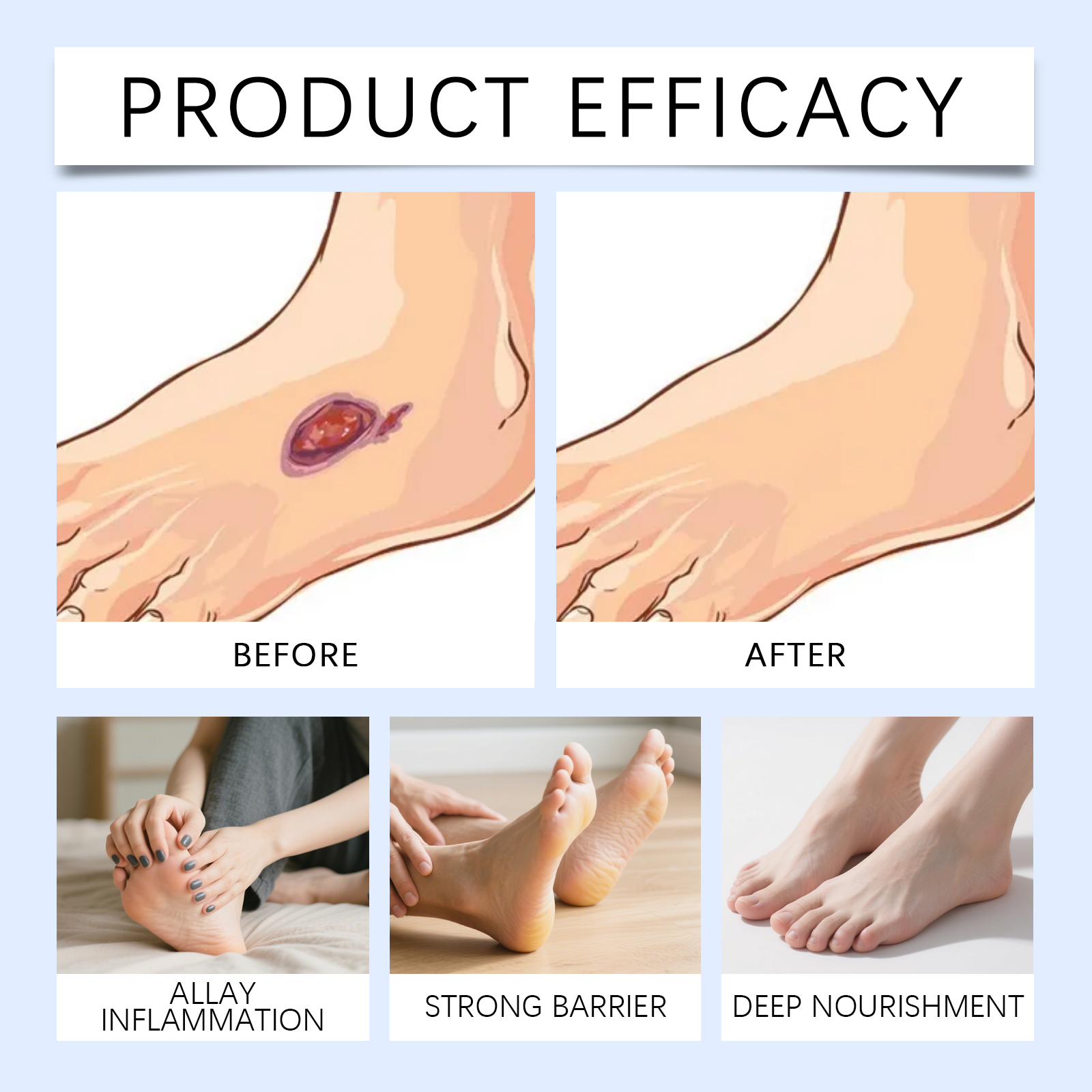 Foot Care Cream Gentle Light Texture Skin Fresh Soft Smooth Comfort Daily Apply For Foot Treatment