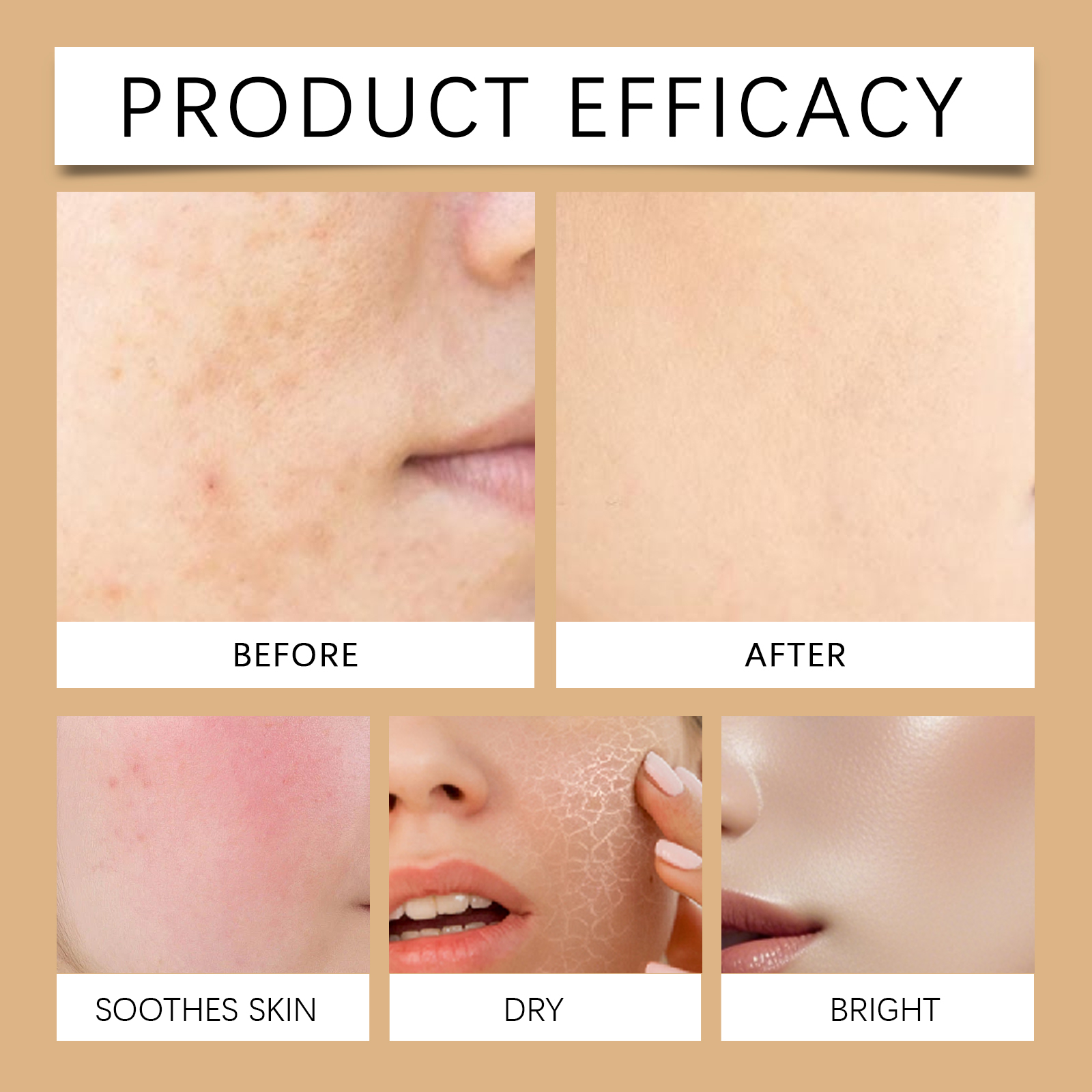Brightening Serum Fades Facial Fine Lines Imperfections Brightens Moisturizes Balances Oil Minimizes Pores