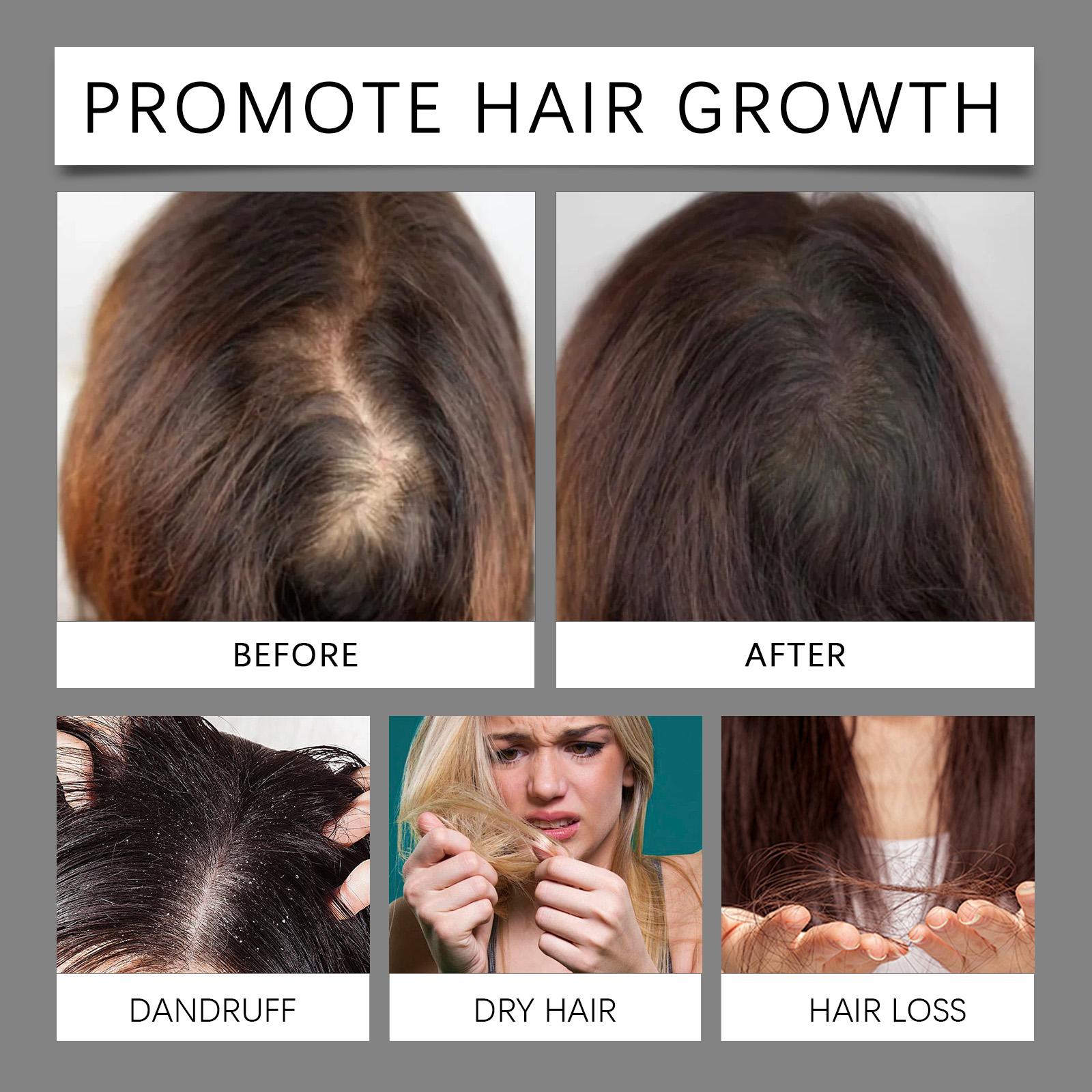 Hair Care Essence Nourishes Hair Follicles Improves Hair Texture Moisturizes Scalp Revitalizes Shiny Tresses