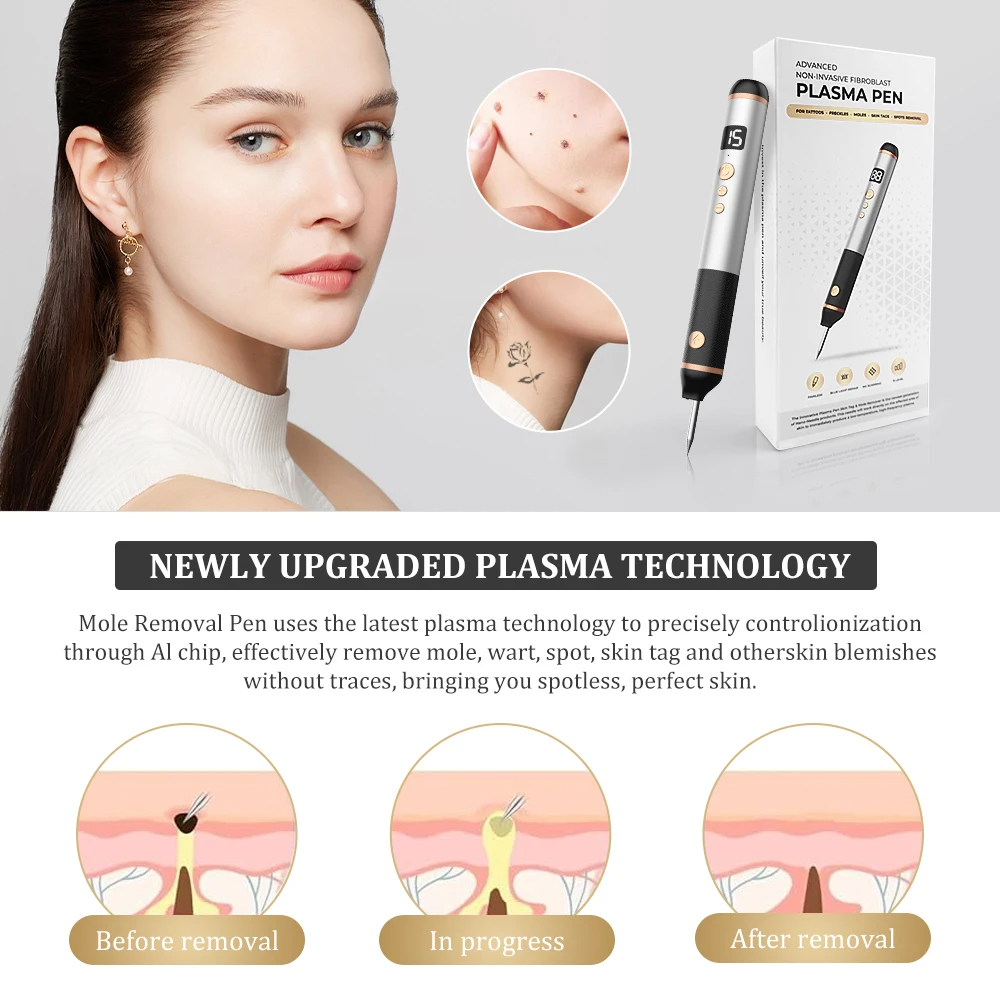 Black Spot Wart Removal Pen Skin Label Removal Laser Plasma Pen Tattoo Mole Spot Freckle Remover