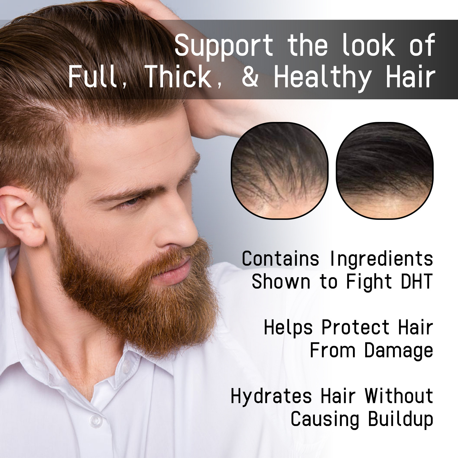 Anti Hair Loss Spray Preventing Baldness Reduce Dandruff Itching Regrowth Thicker Strengthen Nourishing Scalp Treatment Products Hair Care for Men Women