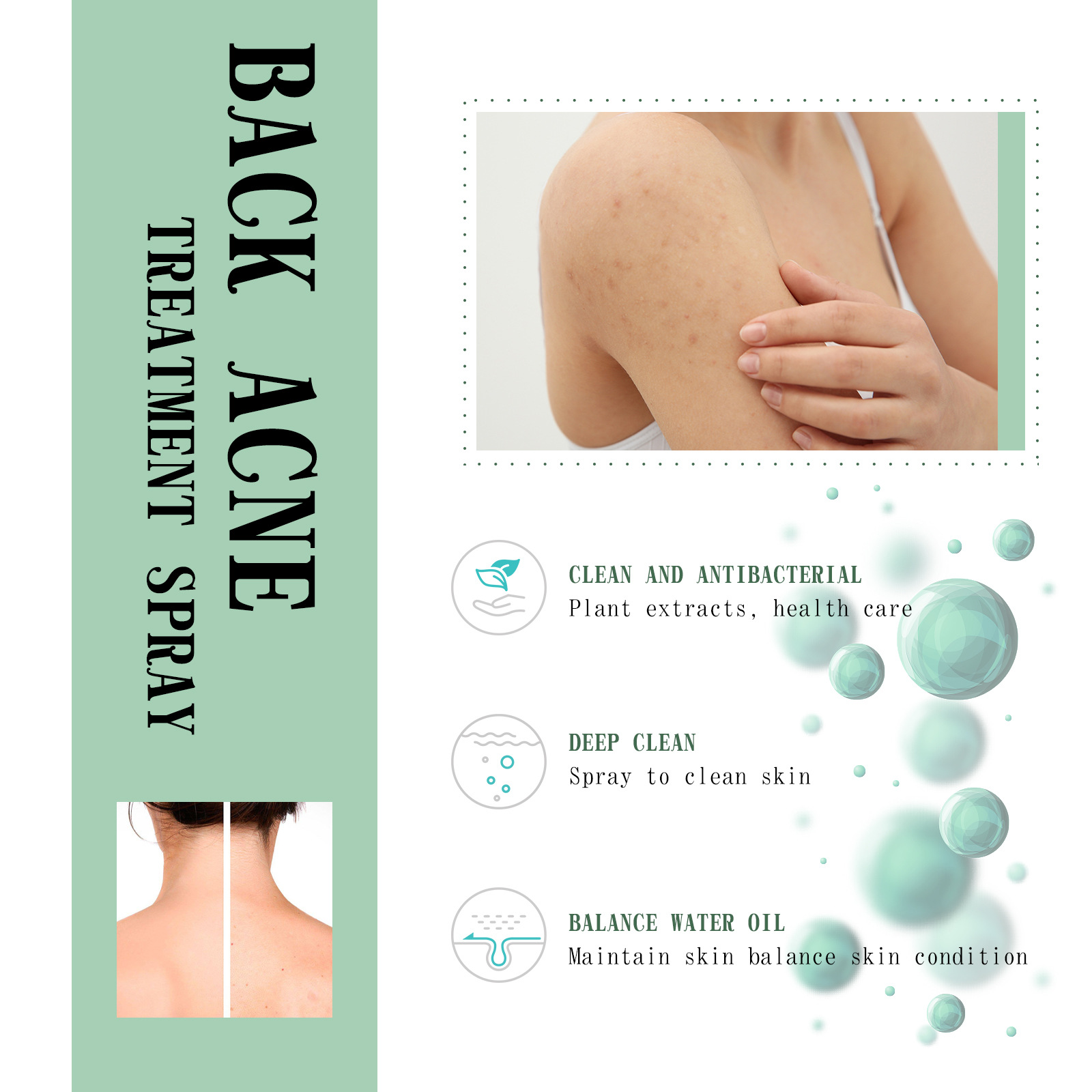 (1 PC) Back Care Spray Back Acne Remover Spray Shoulder Pimple Repair Whiteheads Treatment Blackhead Anti Mites Oil Control Hydrate Body Soothing Serum
