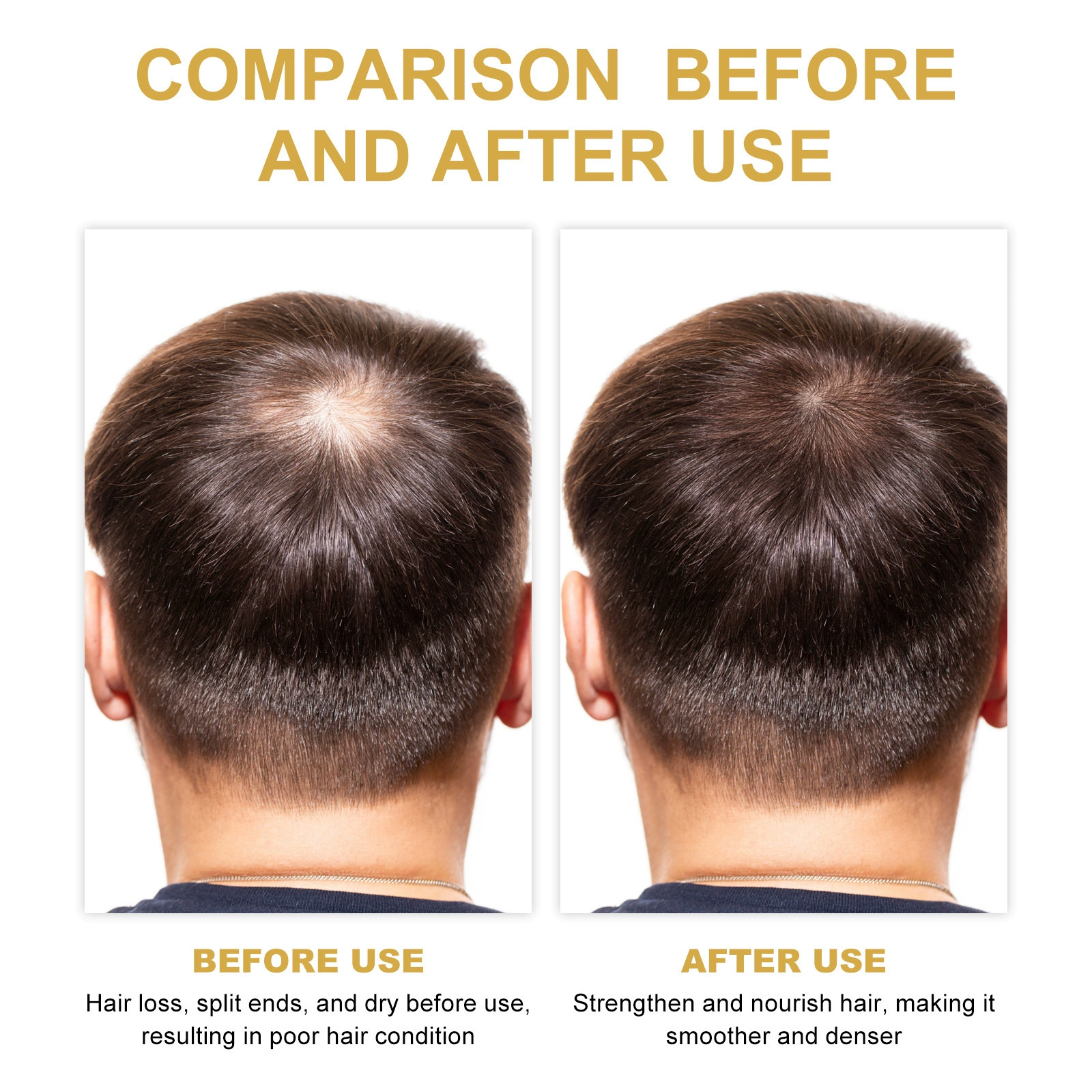 EELHOE Hair Growth Shampoo Rosemary Nourishing Dry Split End Hair Oil Control